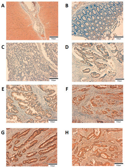 Cancers 12 00134 g0a1
