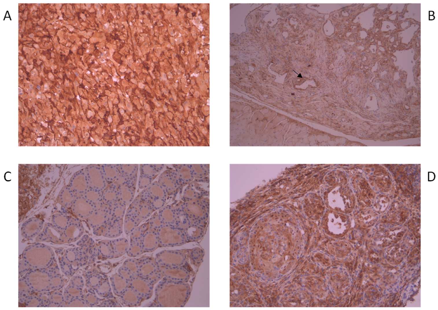 Cancers 12 00145 g002