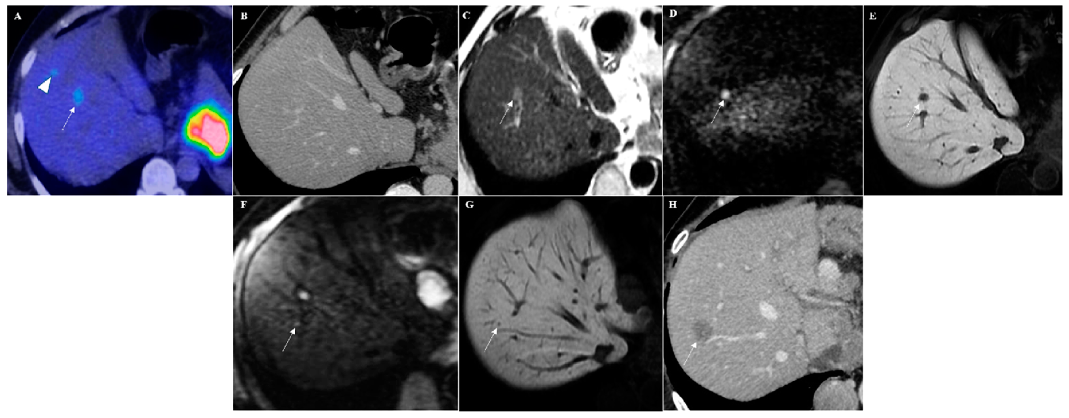 Cancers 12 00151 g001 Cancers 12 00151 g001
