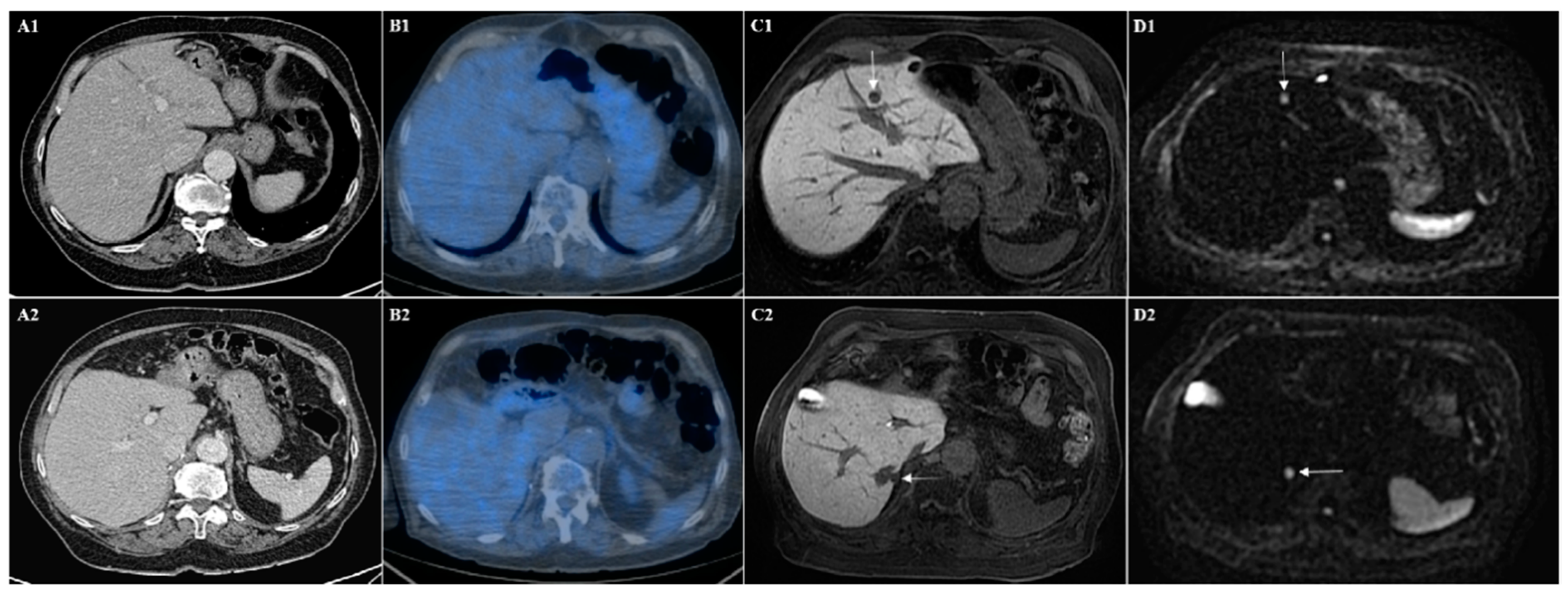 Cancers 12 00151 g002 Cancers 12 00151 g002