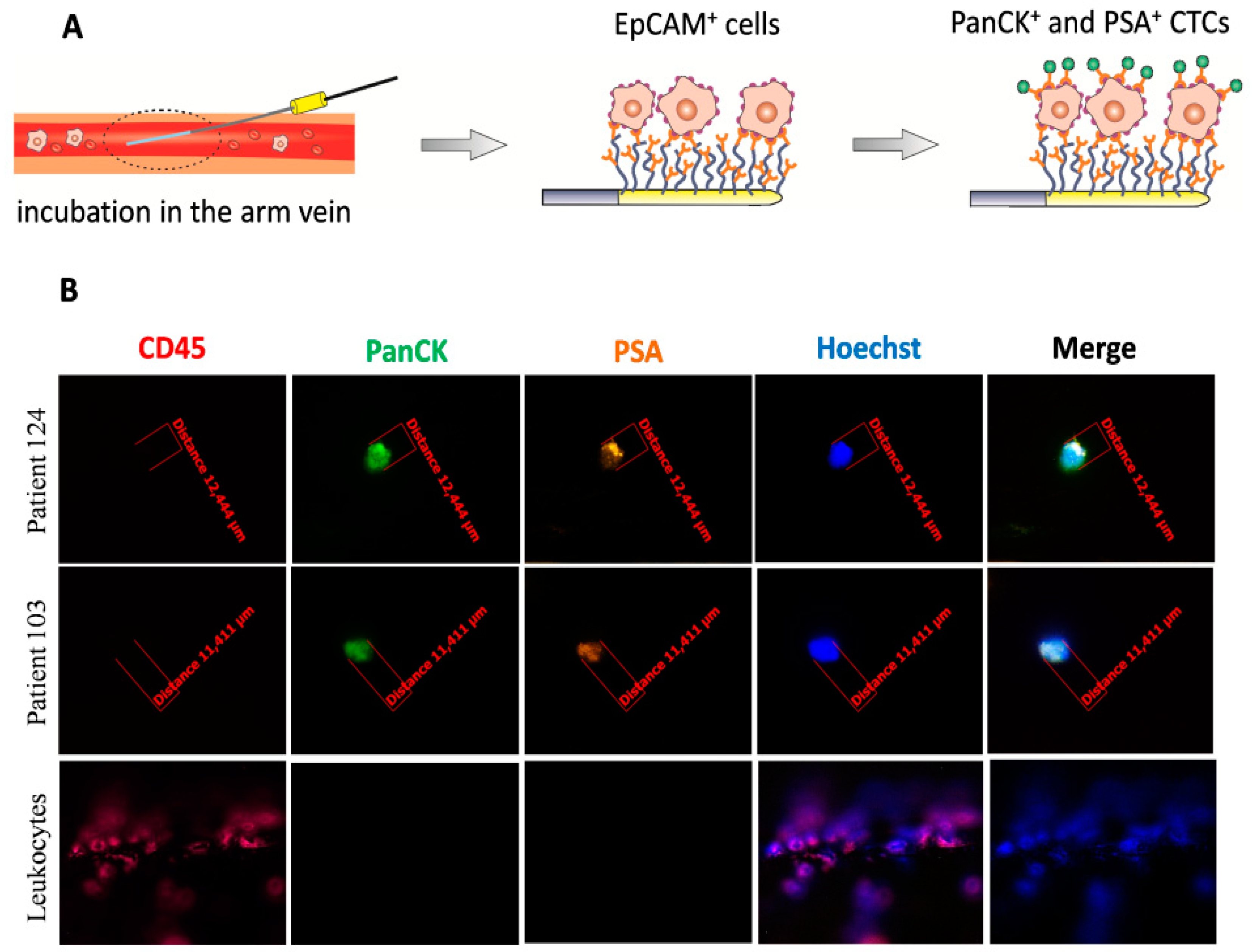 Cancers 12 00160 g003