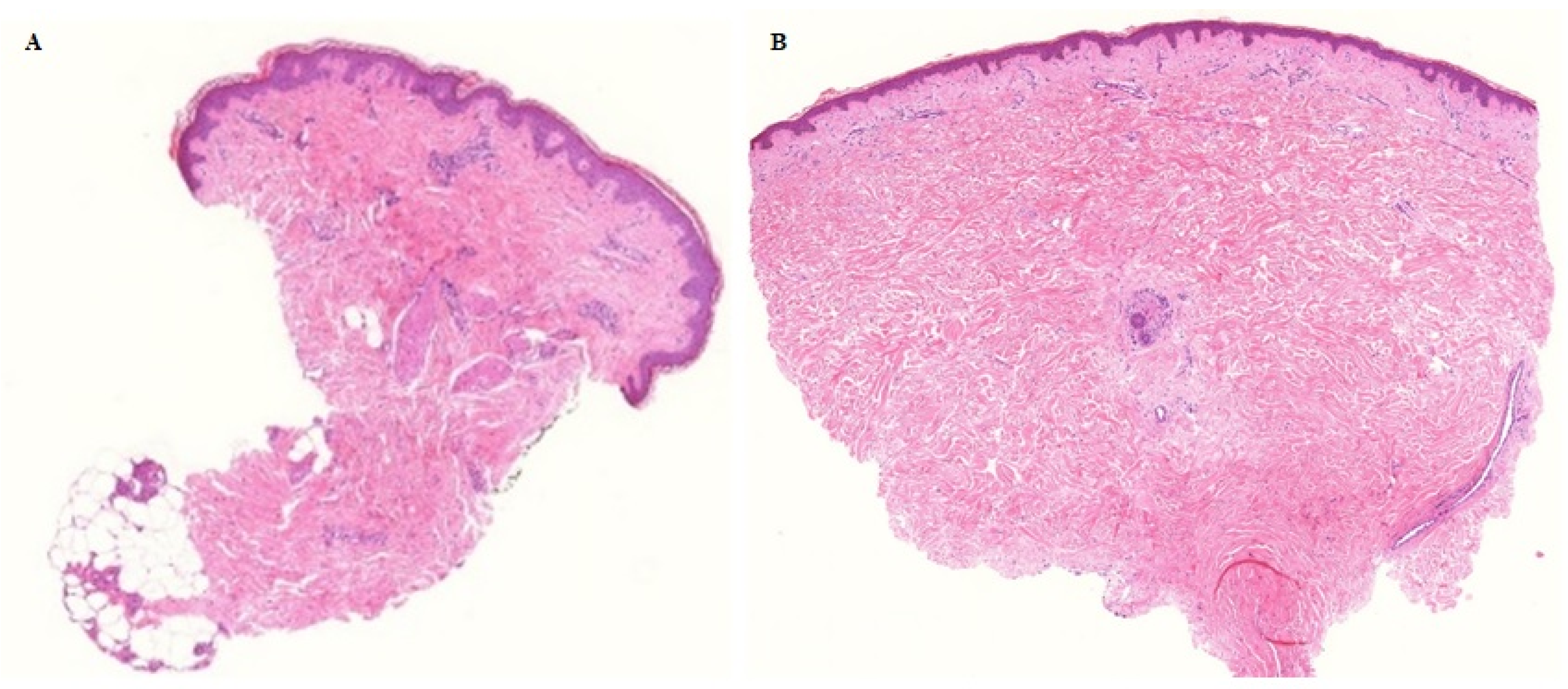 Cancers 12 00179 g004