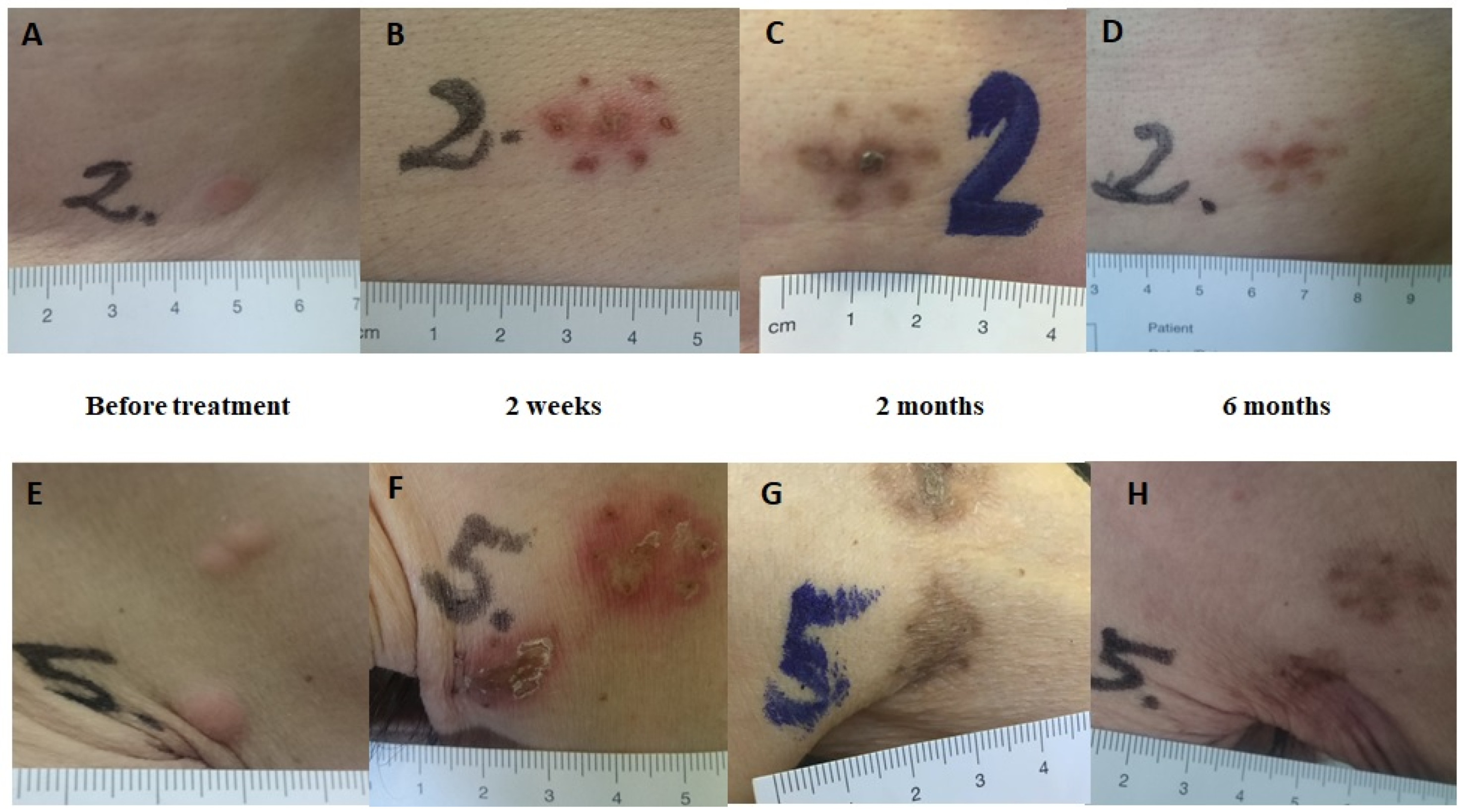 Cancers 12 00179 g005