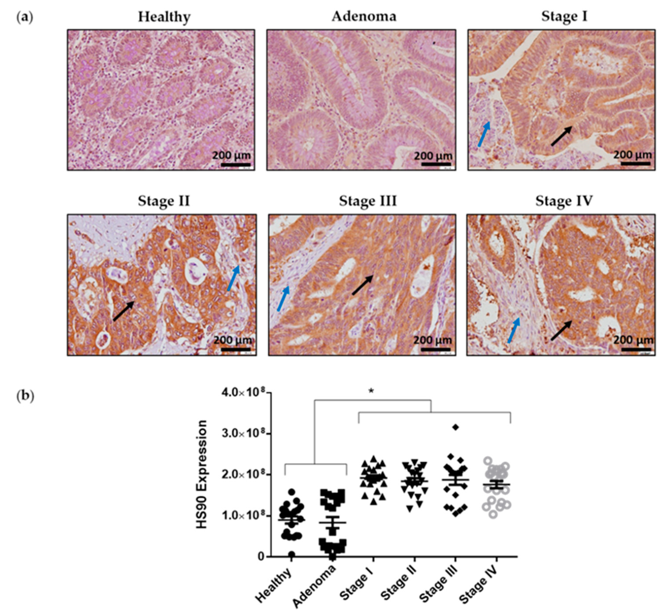 Cancers 12 00215 g009