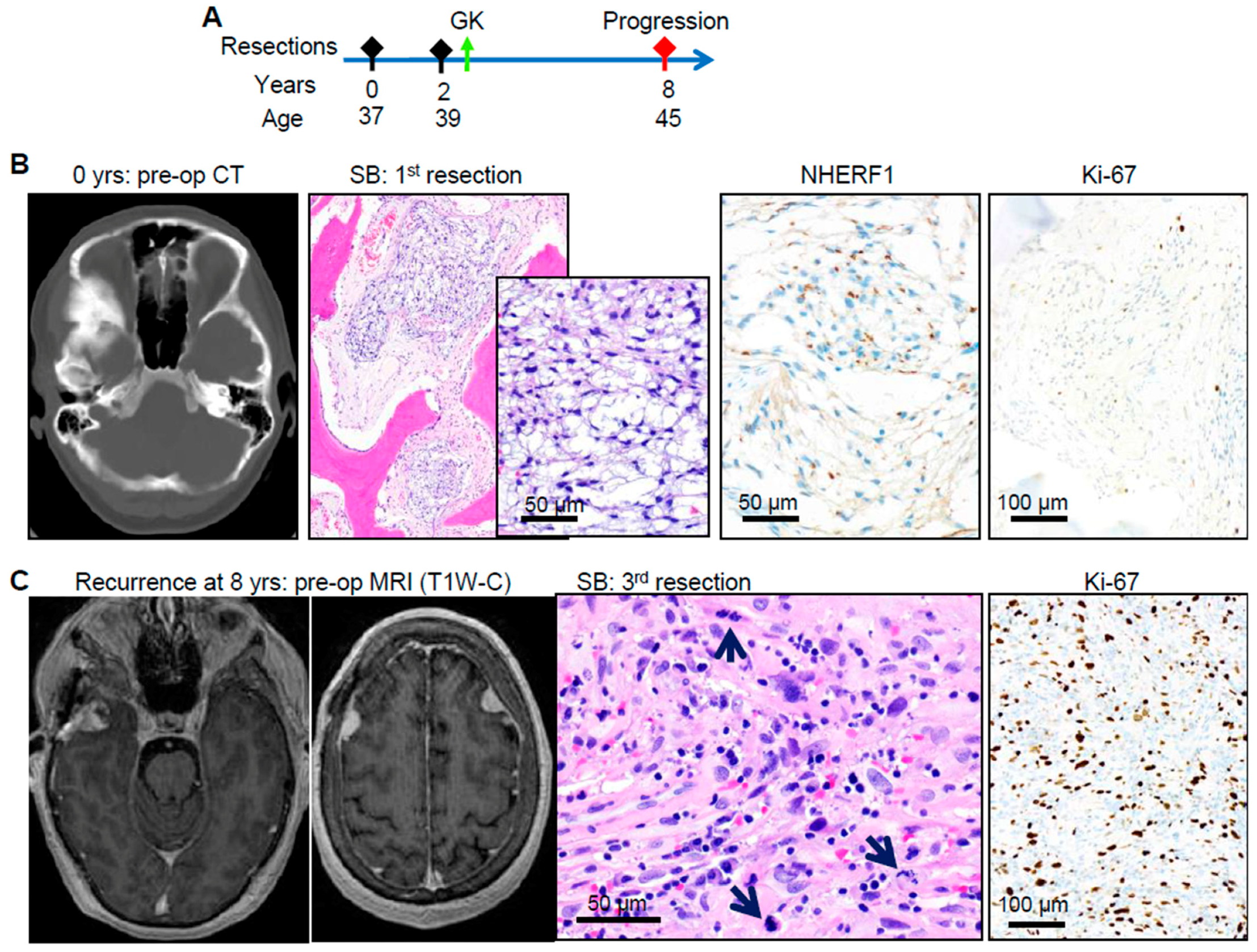 Cancers 12 00225 g004a