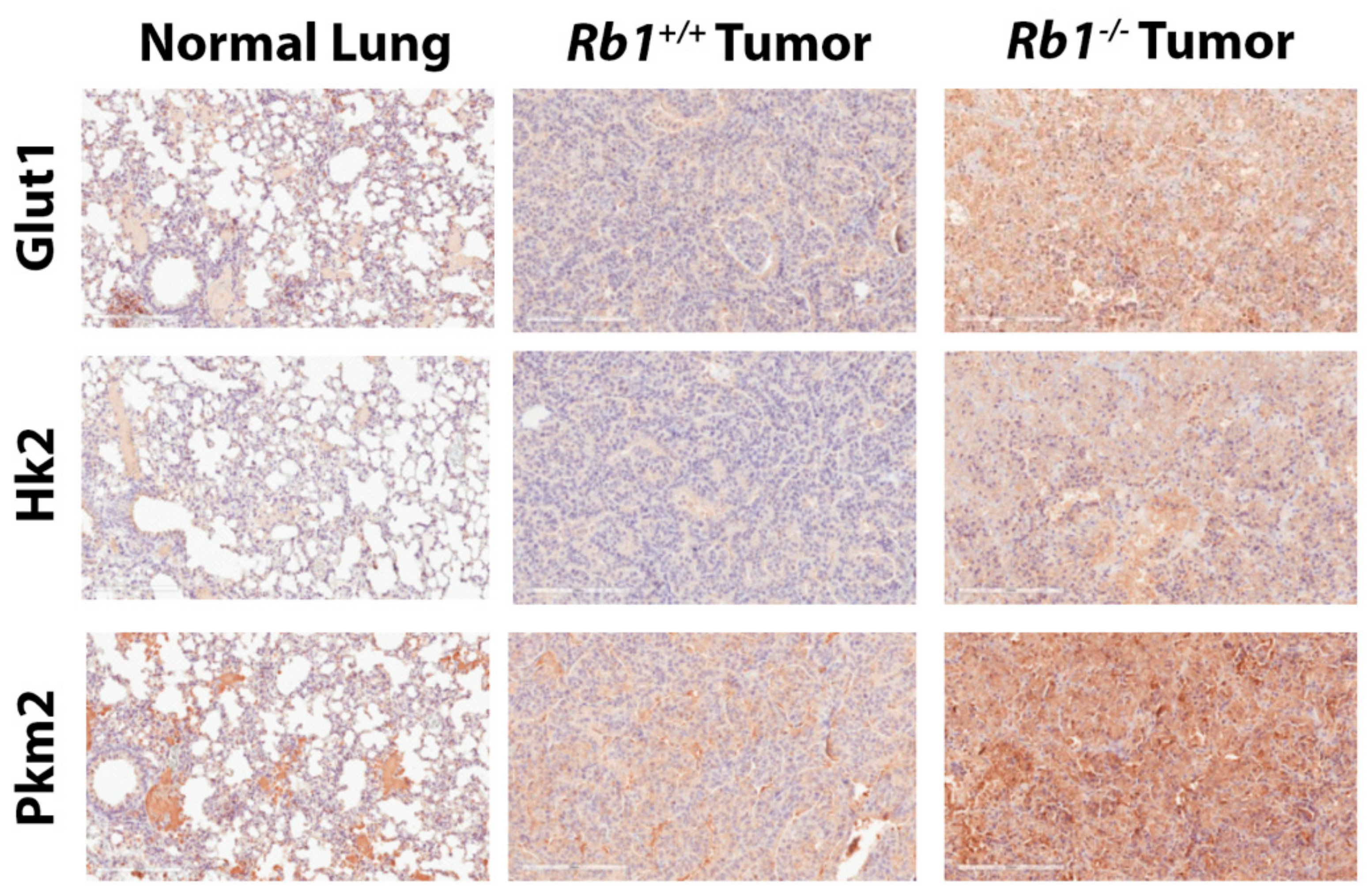 Cancers 12 00237 g004