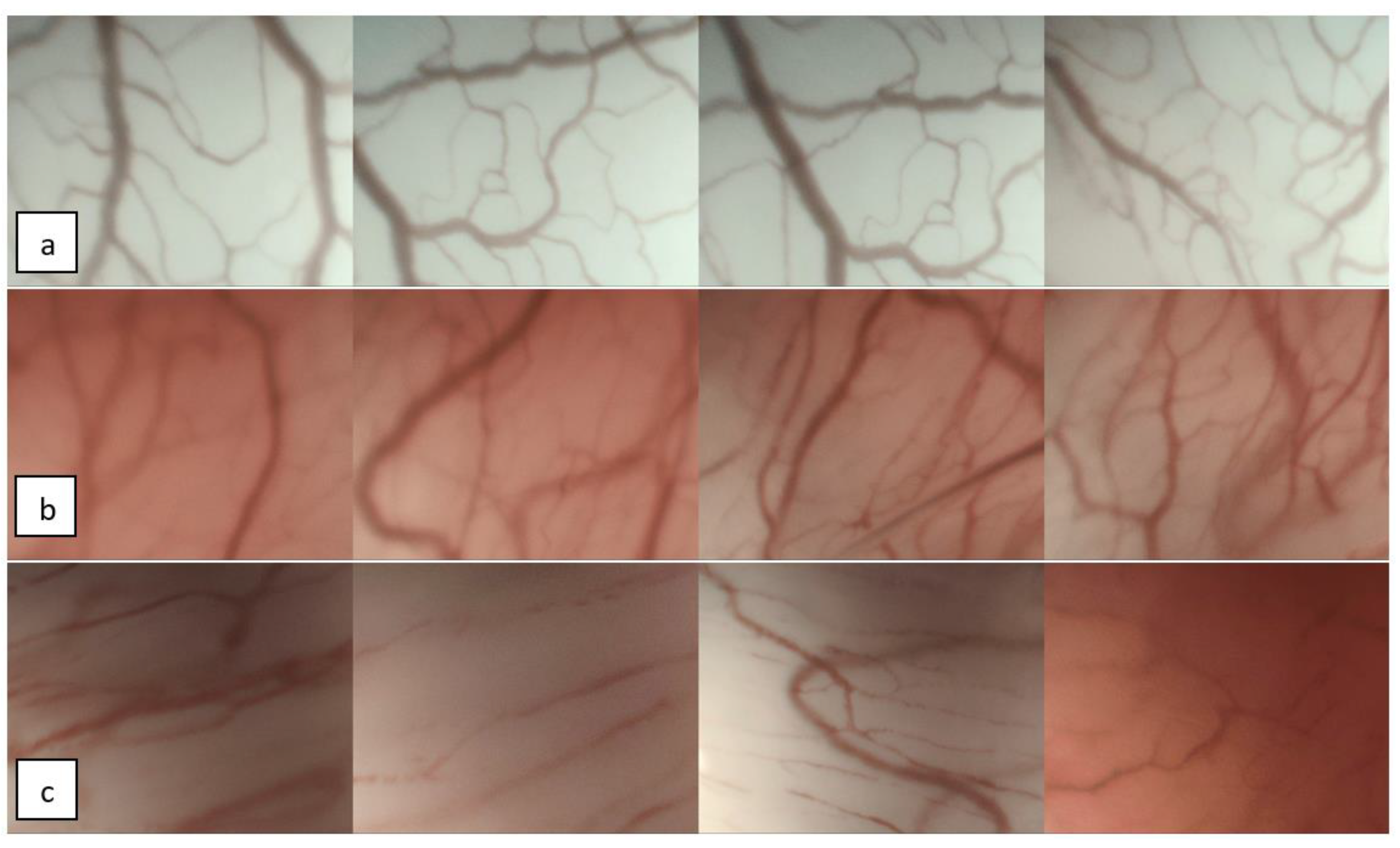 Cancers 12 00248 g002 Cancers 12 00248 g002