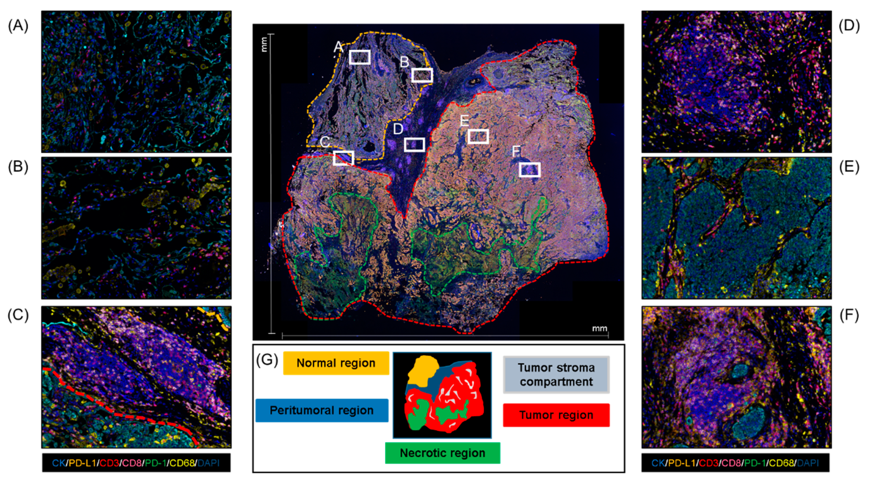 Cancers 12 00255 g004