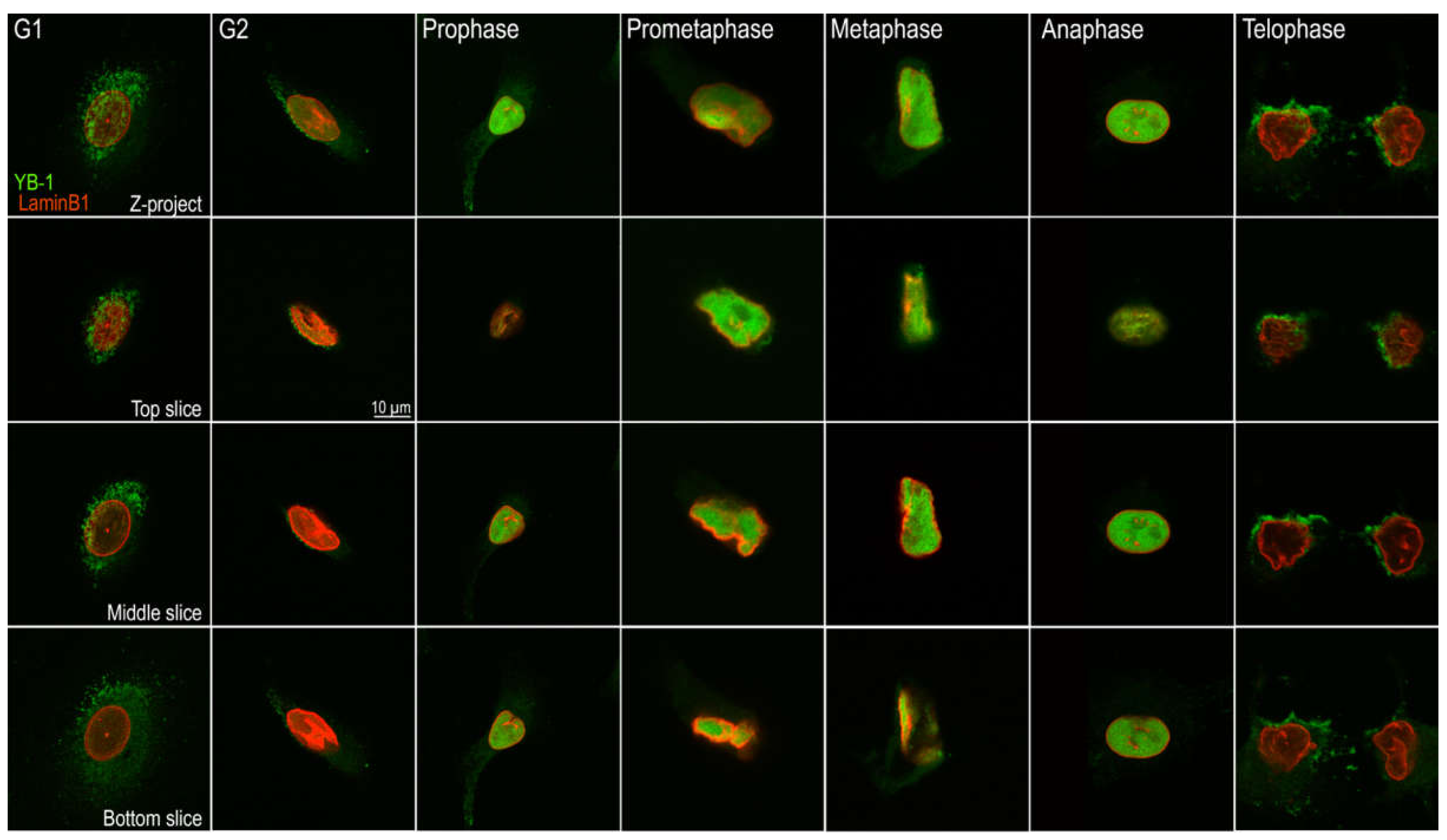 Cancers 12 00315 g004 Cancers 12 00315 g004