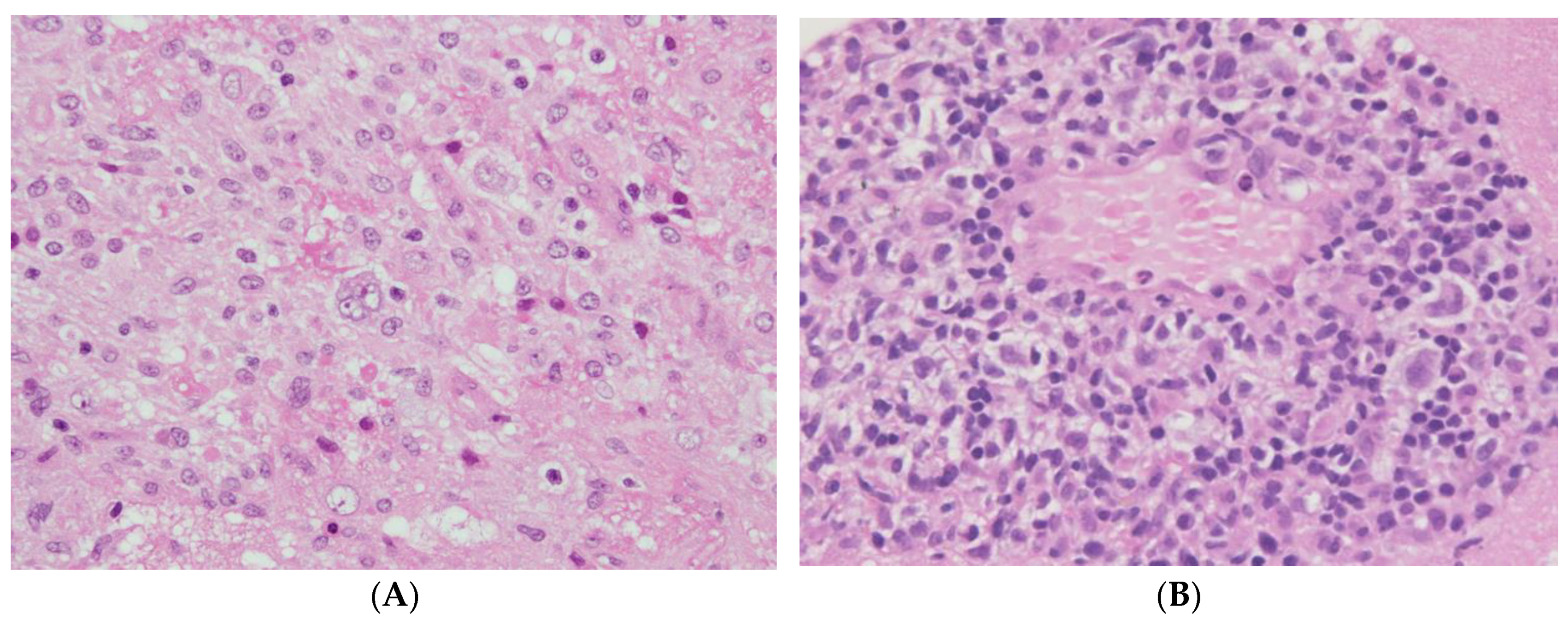 Cancers 12 00328 g003