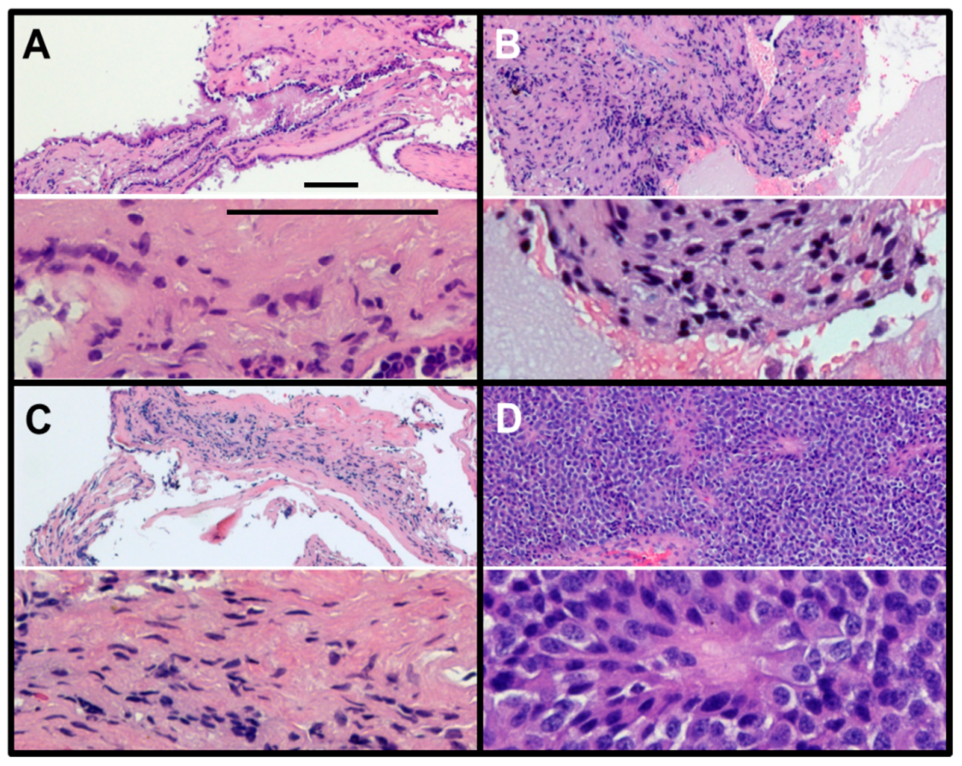 Cancers 12 00360 g003