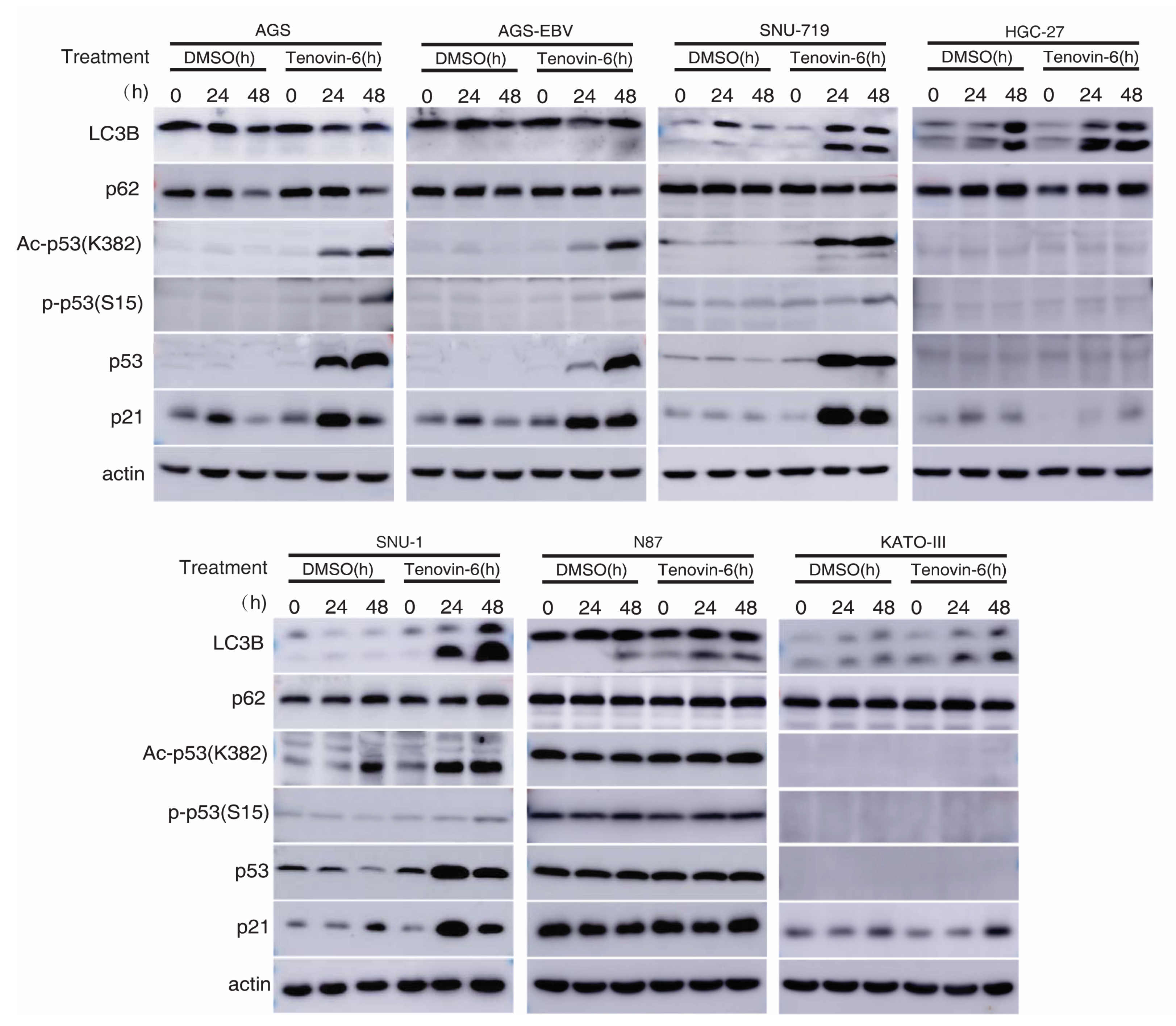 Cancers 12 00365 g003