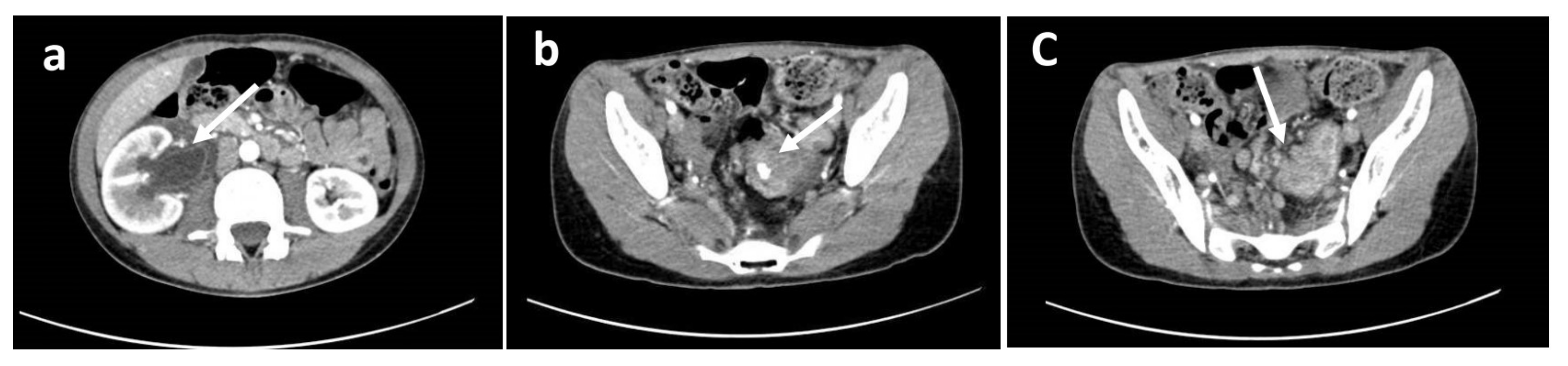 Cancers 12 00414 g001