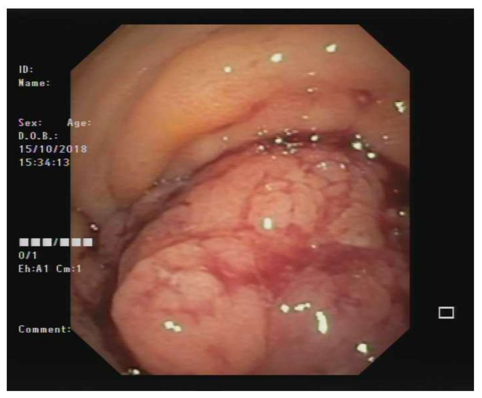 Cancers 12 00414 g002