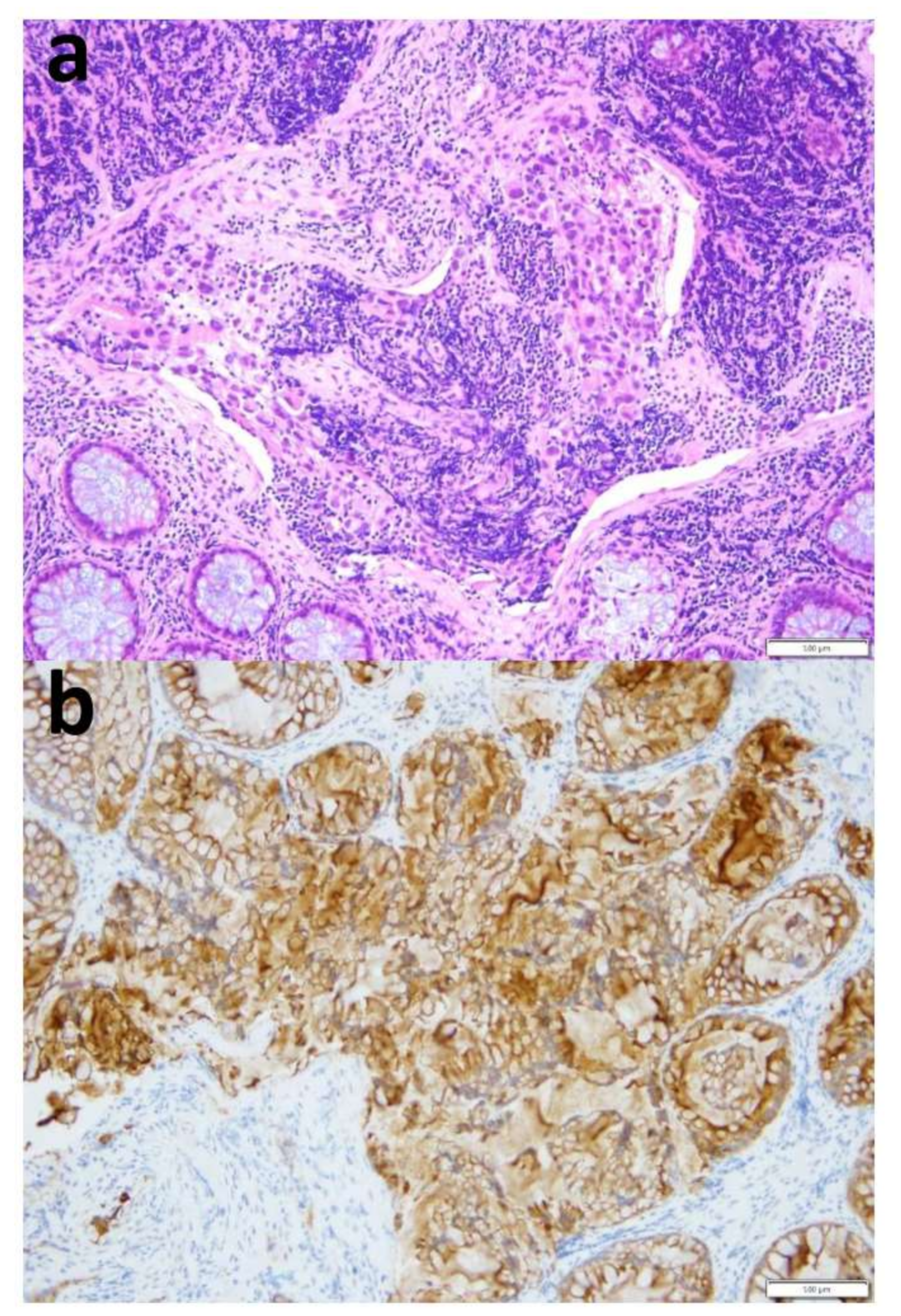 Cancers 12 00414 g003