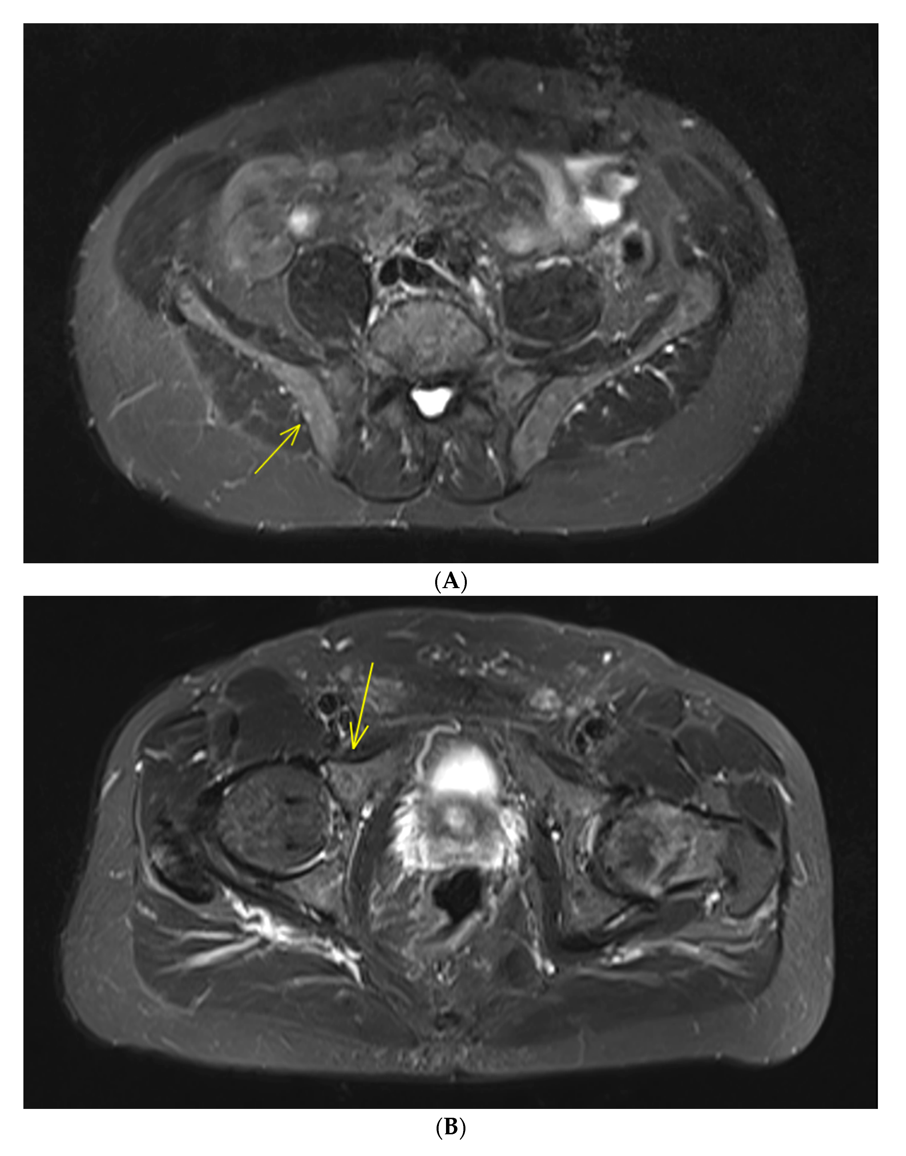 Cancers 12 00486 g001a