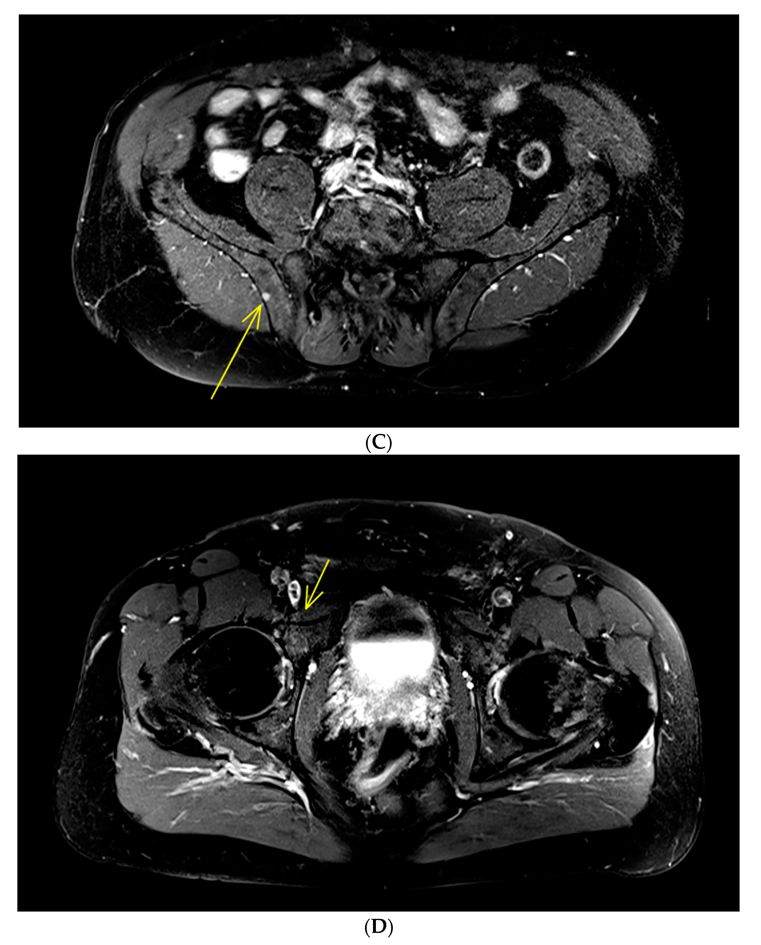 Cancers 12 00486 g001b
