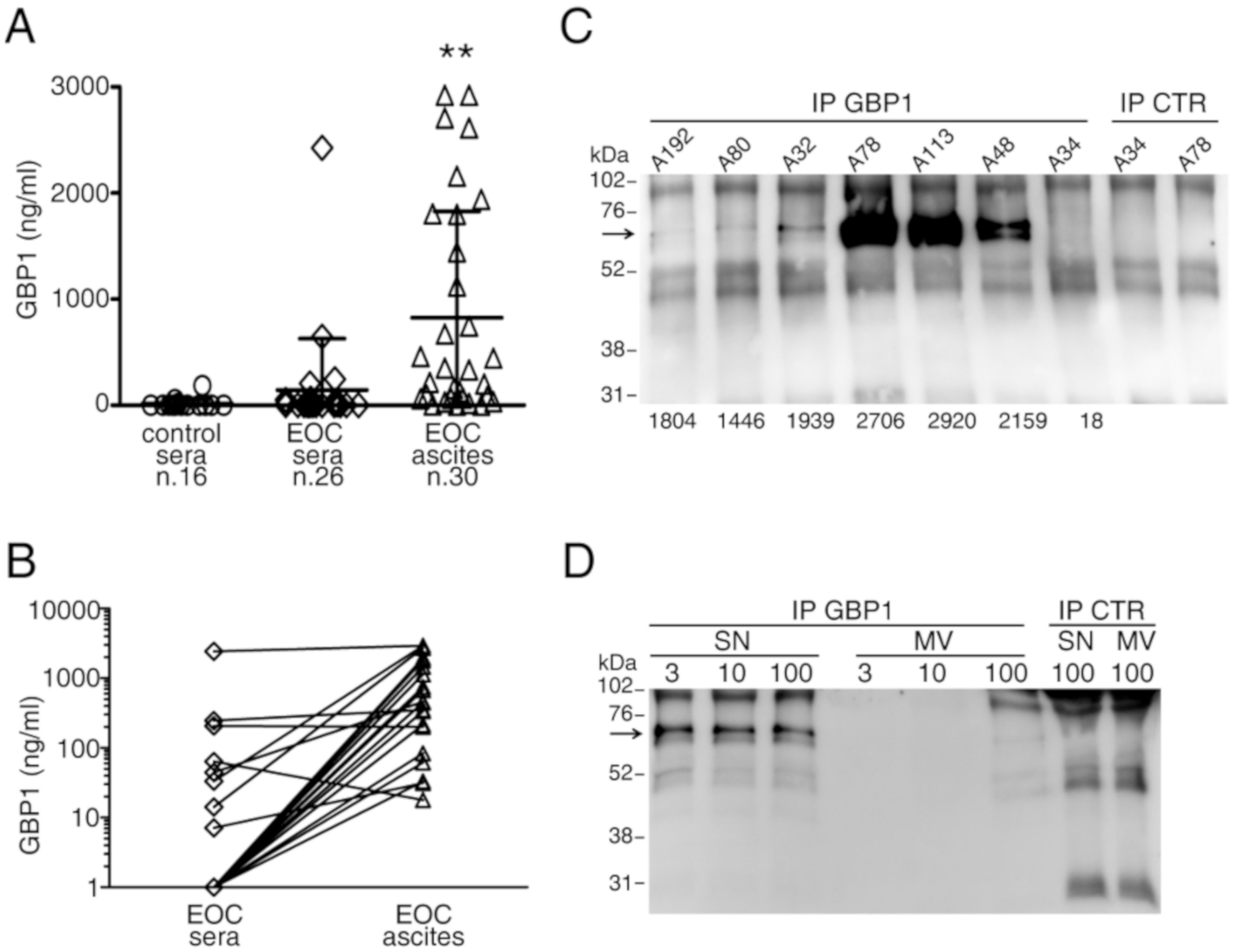 Cancers 12 00488 g005
