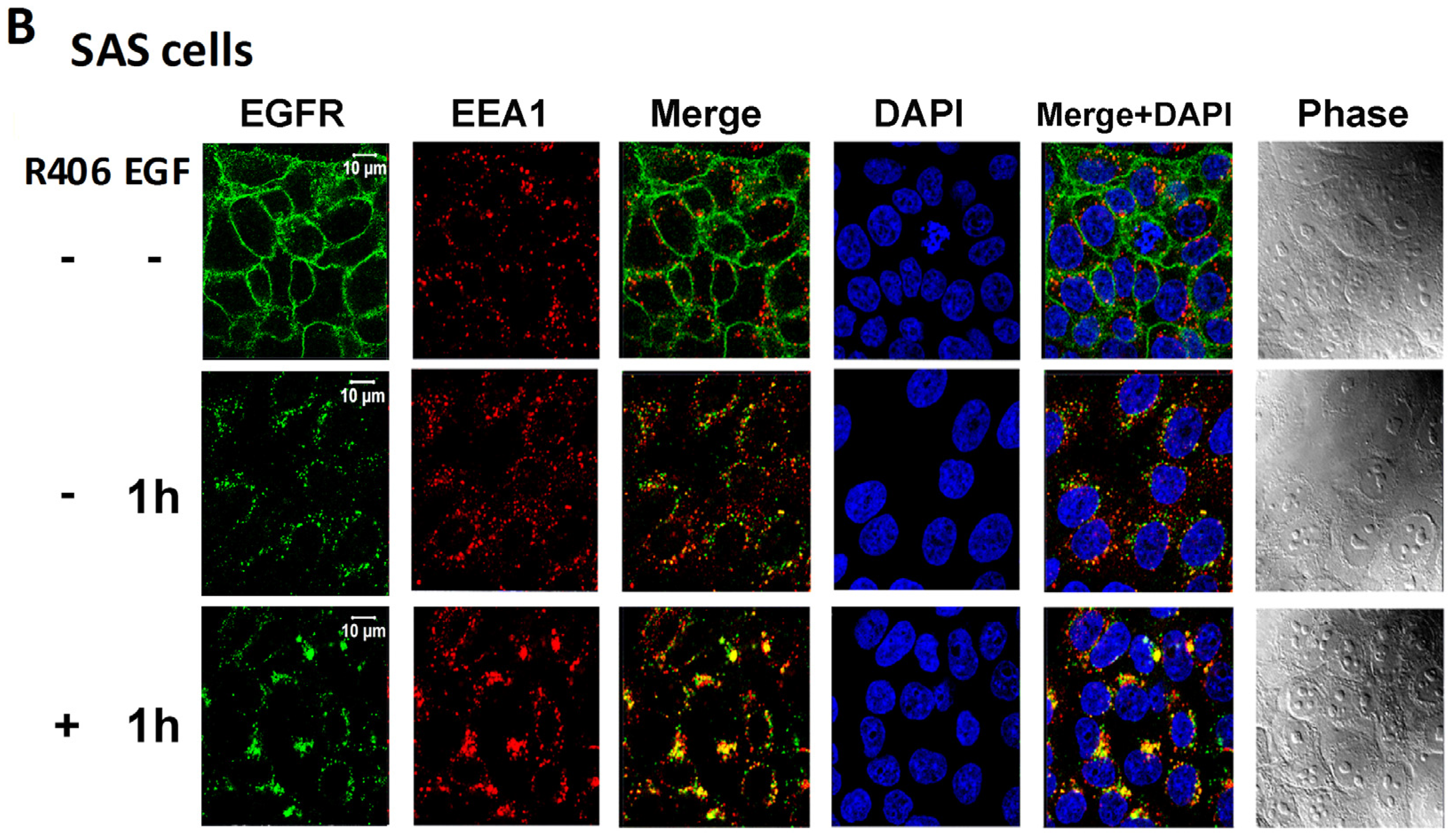 Cancers 12 00489 g005b