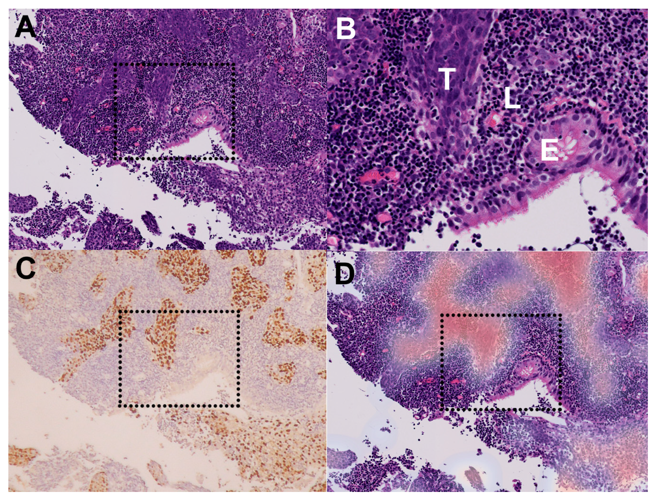 Cancers 12 00507 g004