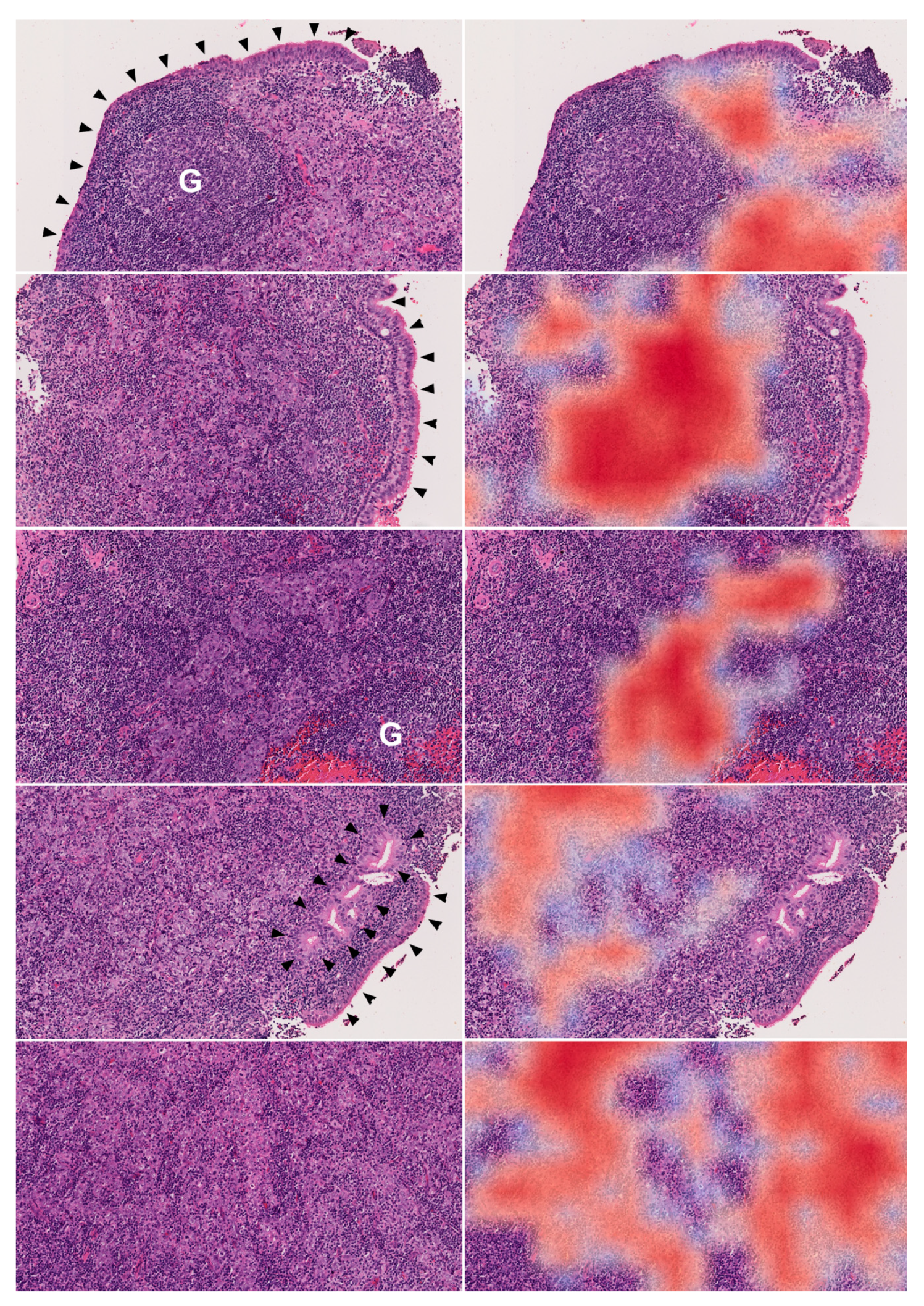 Cancers 12 00507 g005