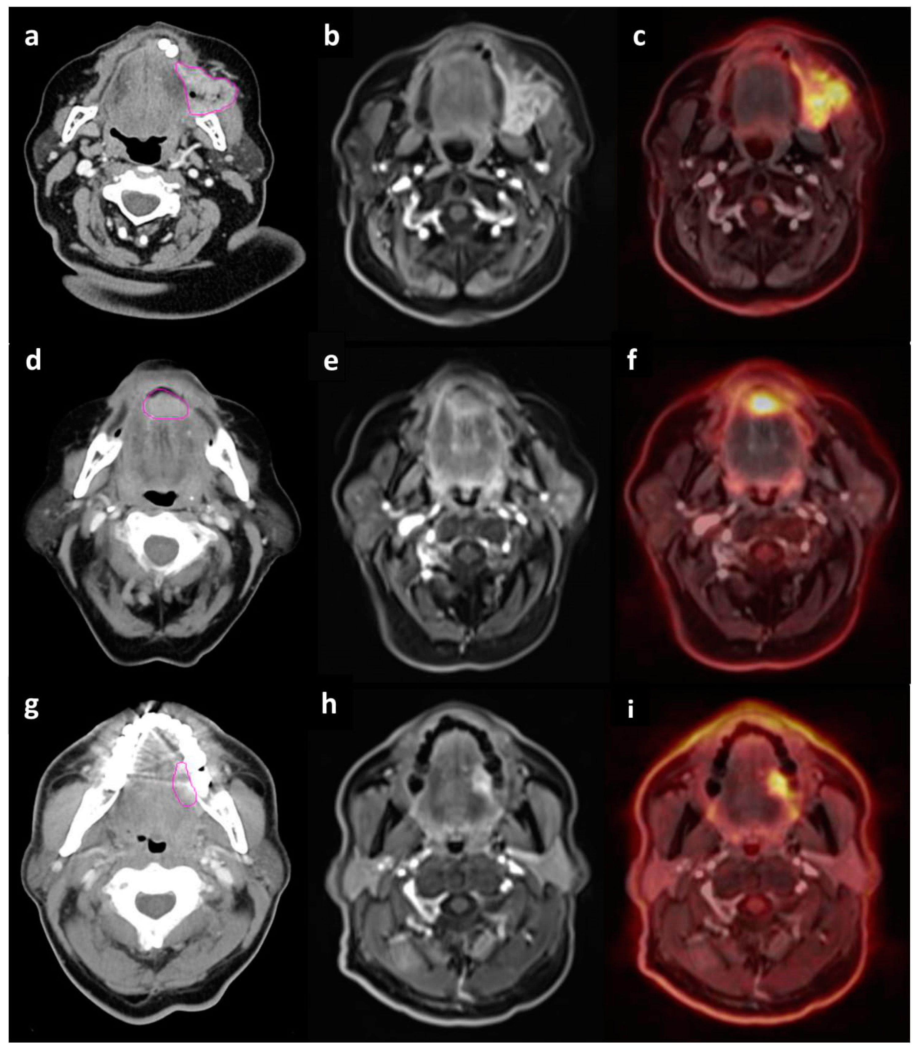 Cancers 12 00511 g002