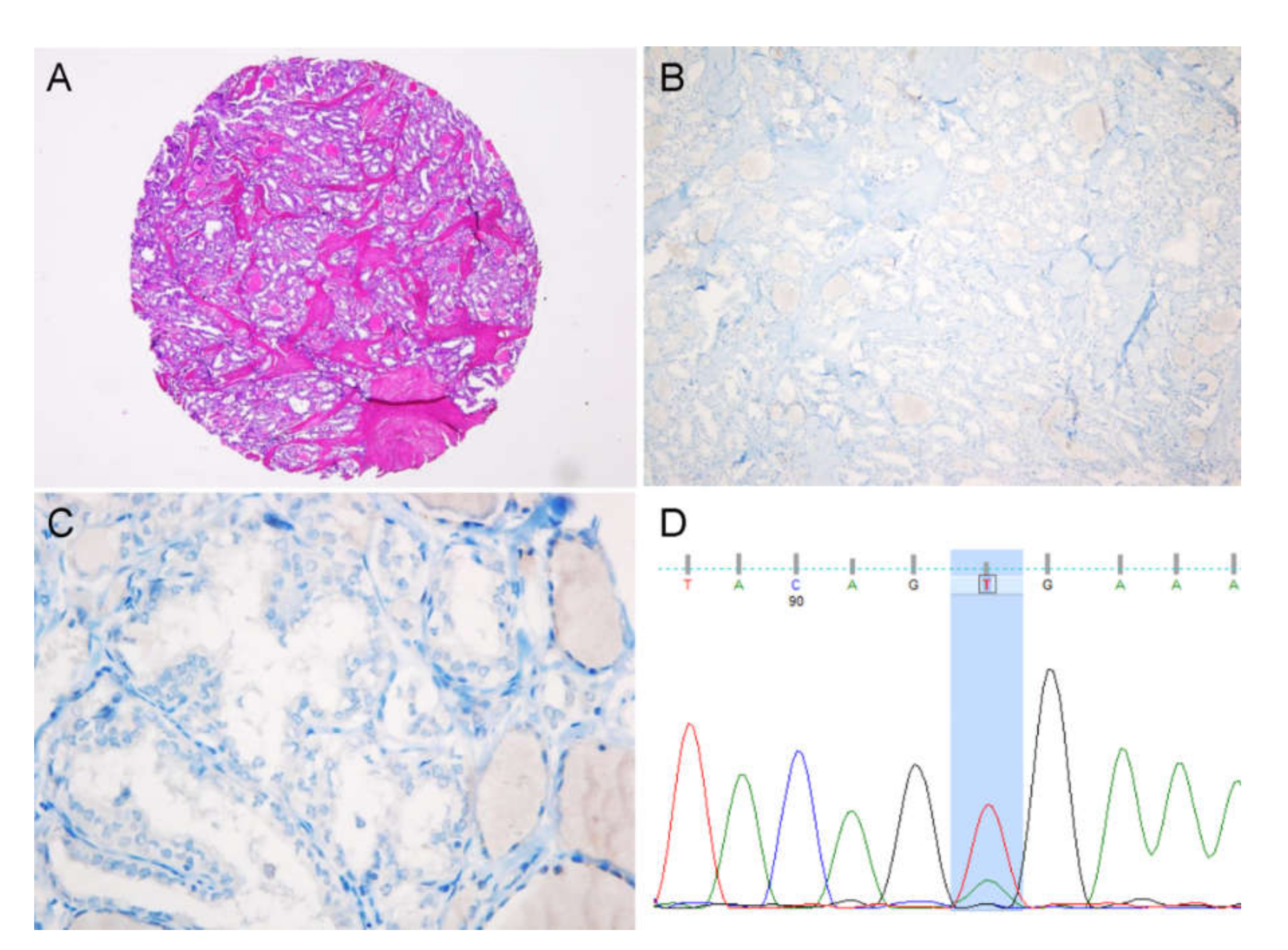 Cancers 12 00596 g004