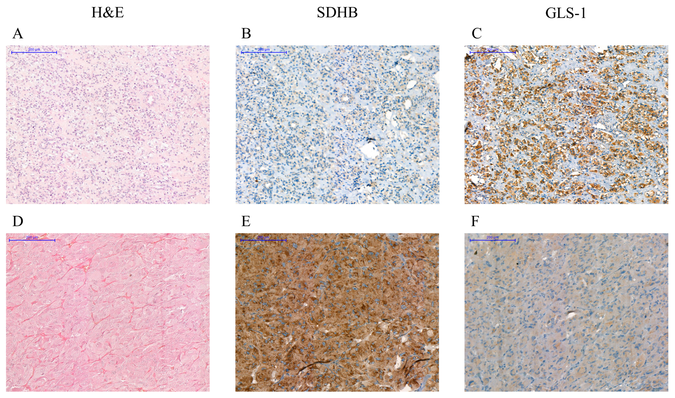 Cancers 12 00599 g006