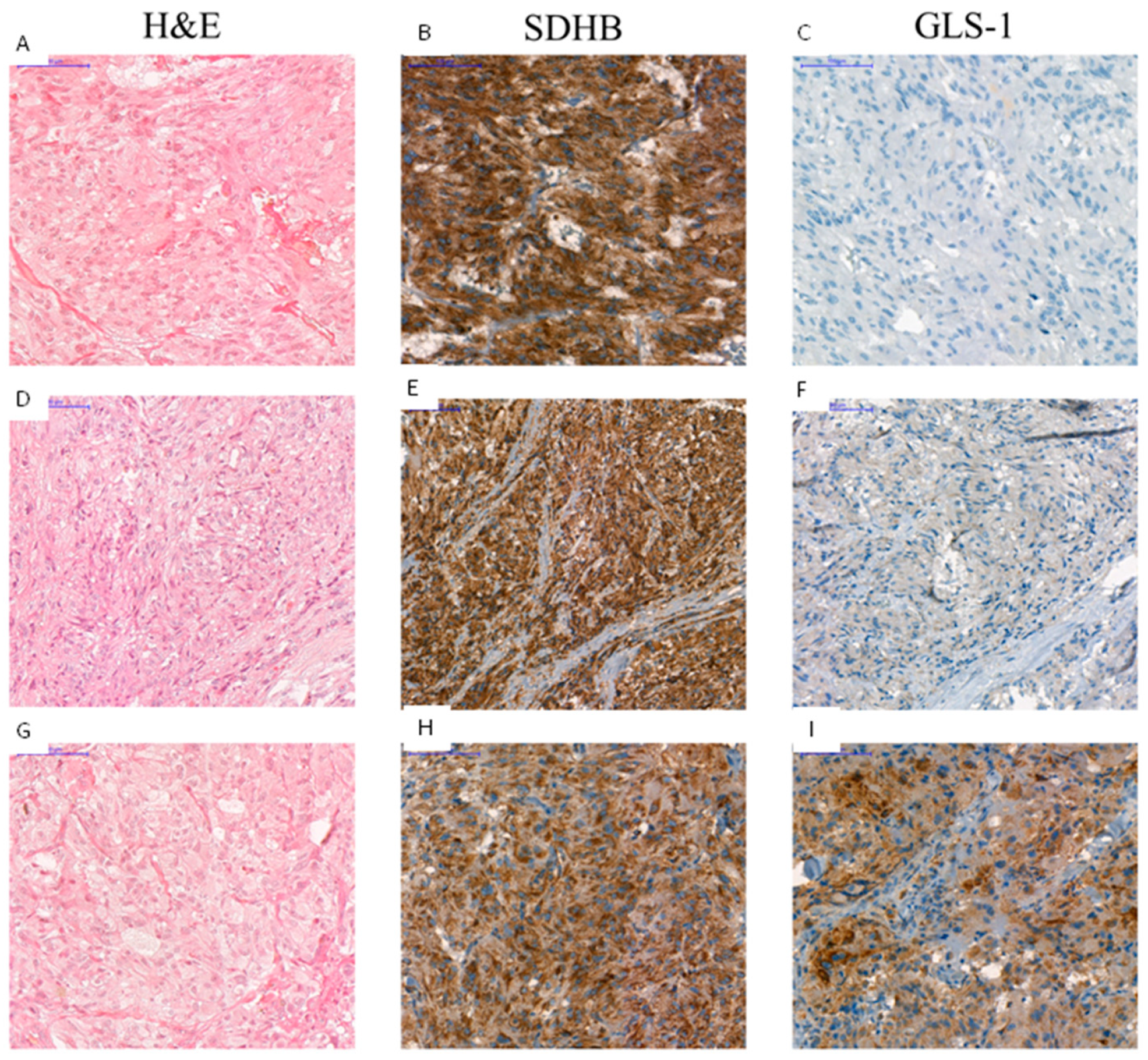 Cancers 12 00599 g007