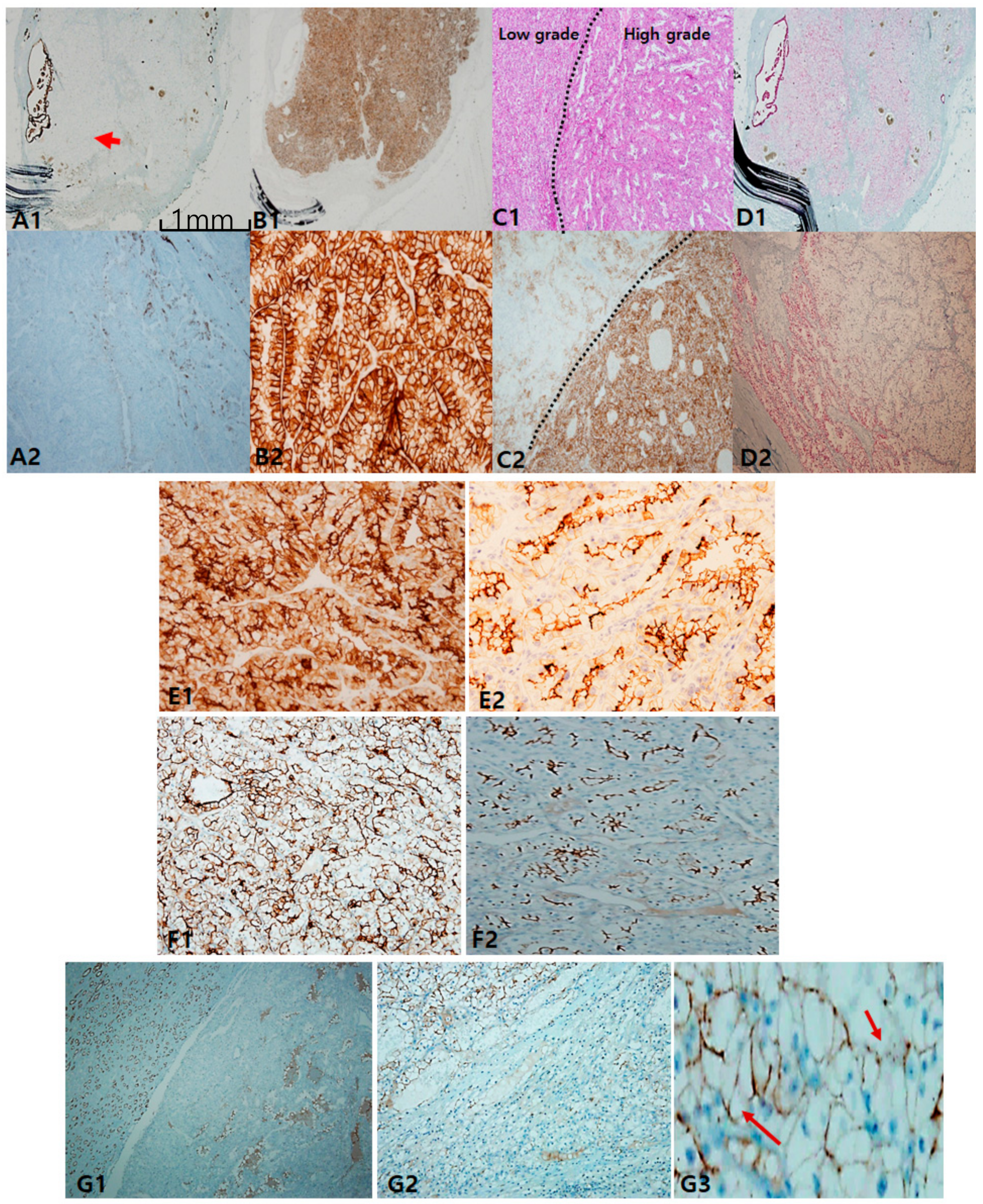 Cancers 12 00602 g001