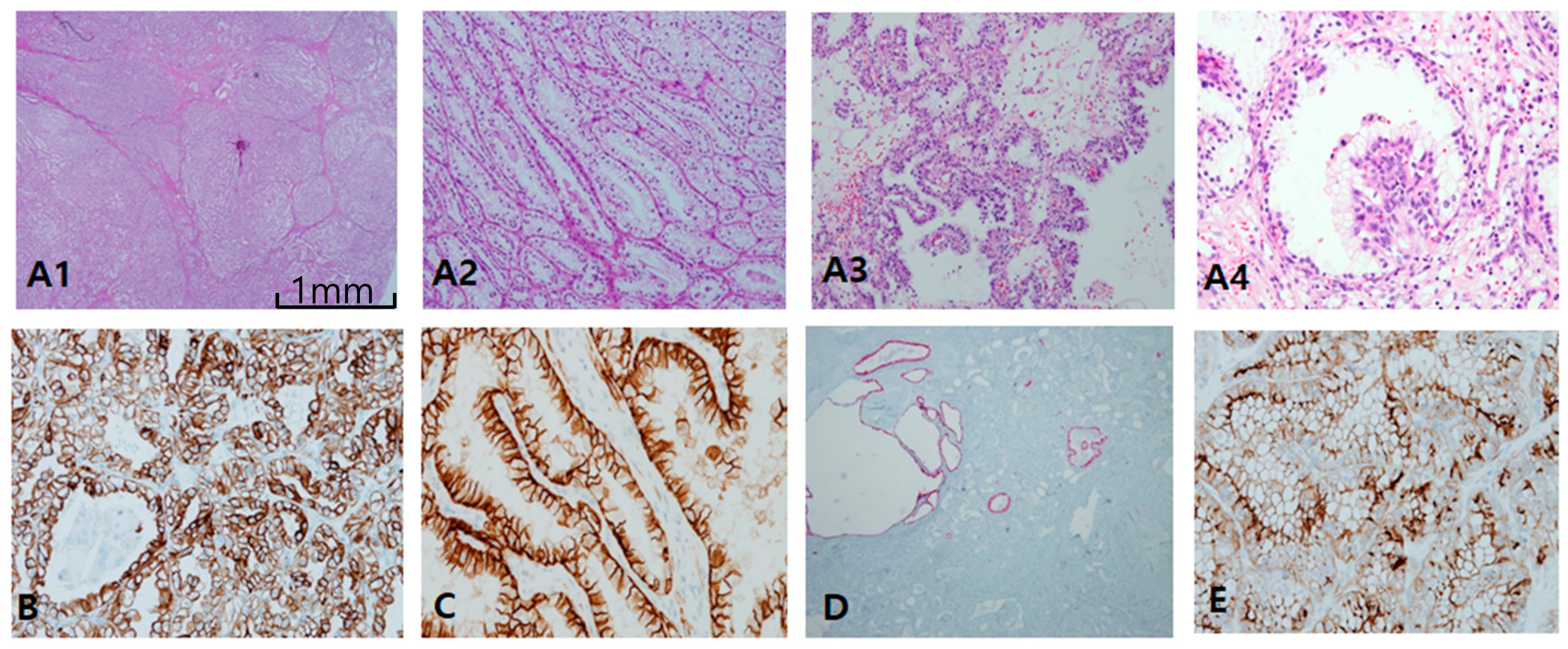 Cancers 12 00602 g003