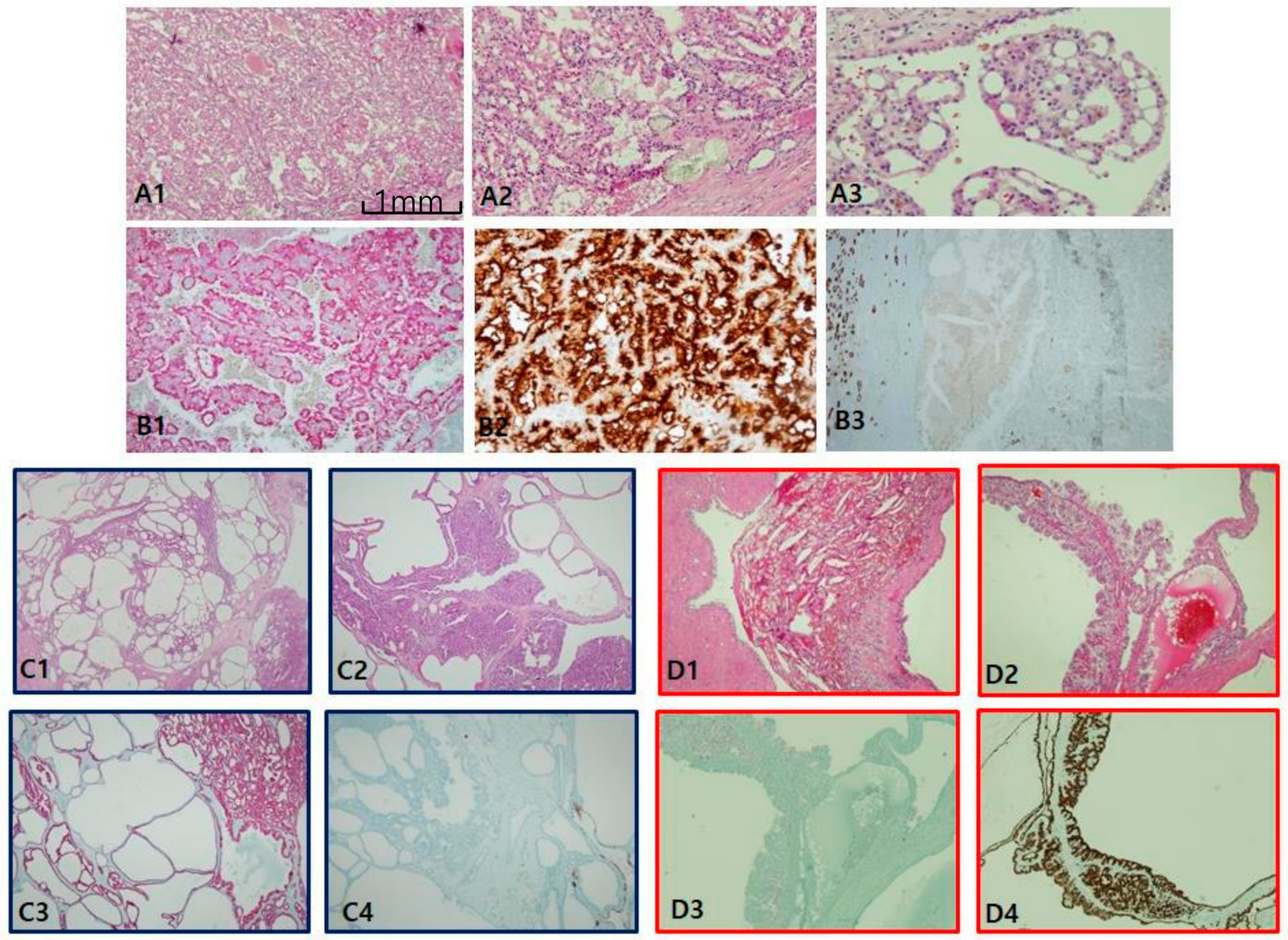 Cancers 12 00602 g004