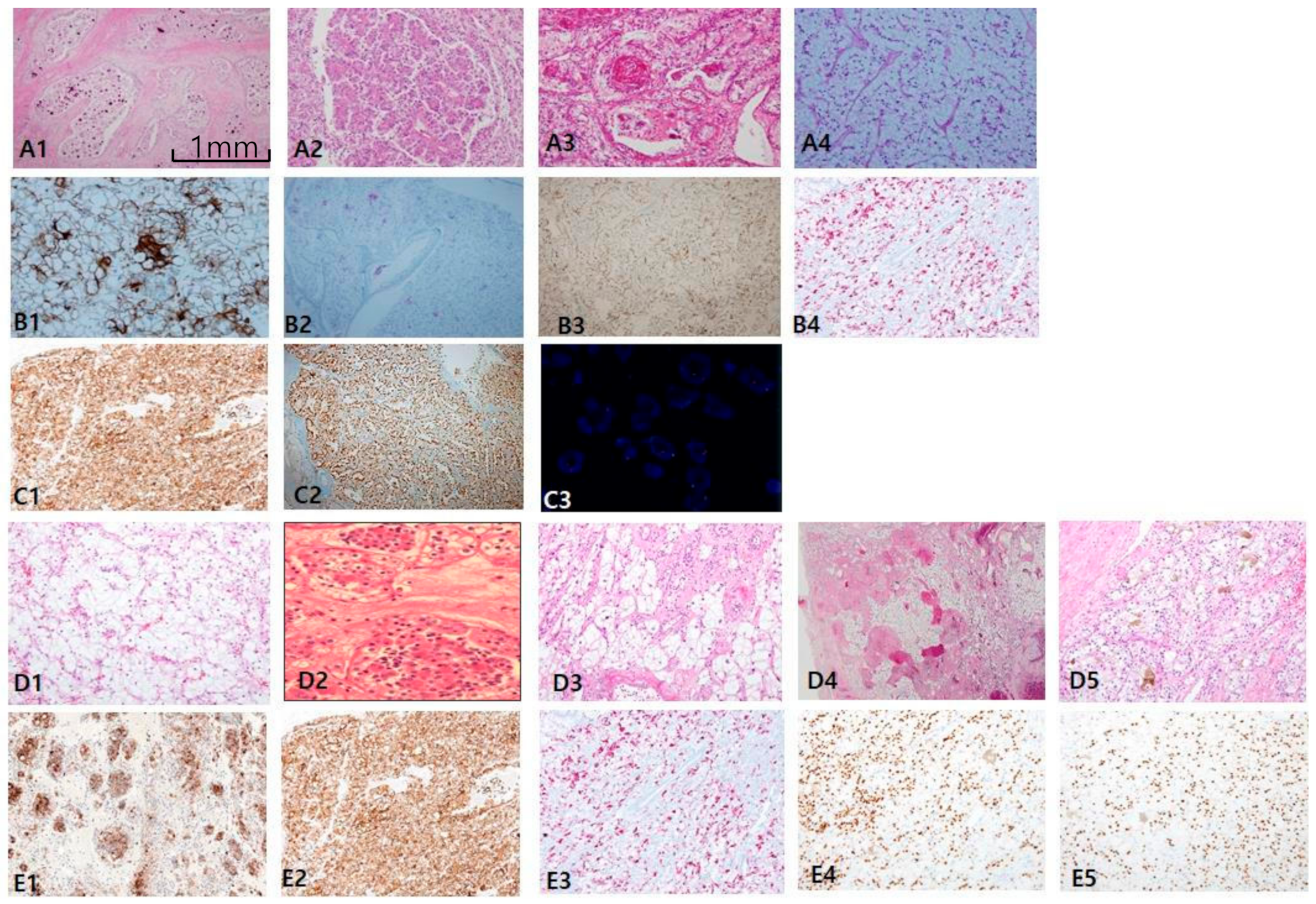 Cancers 12 00602 g005