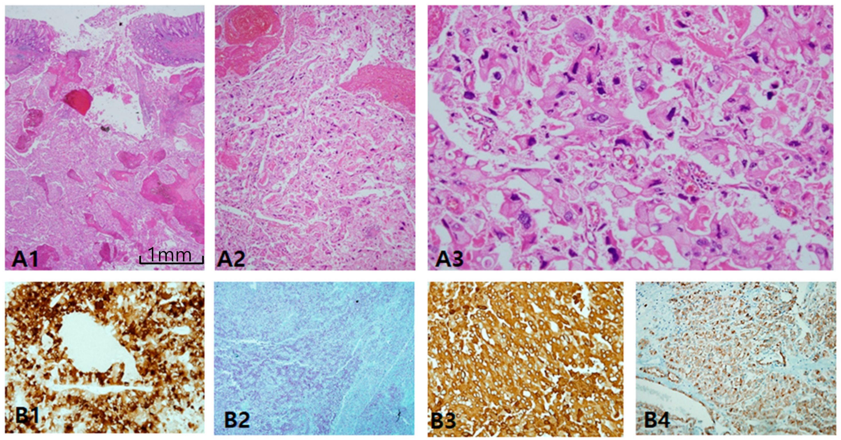 Cancers 12 00602 g007