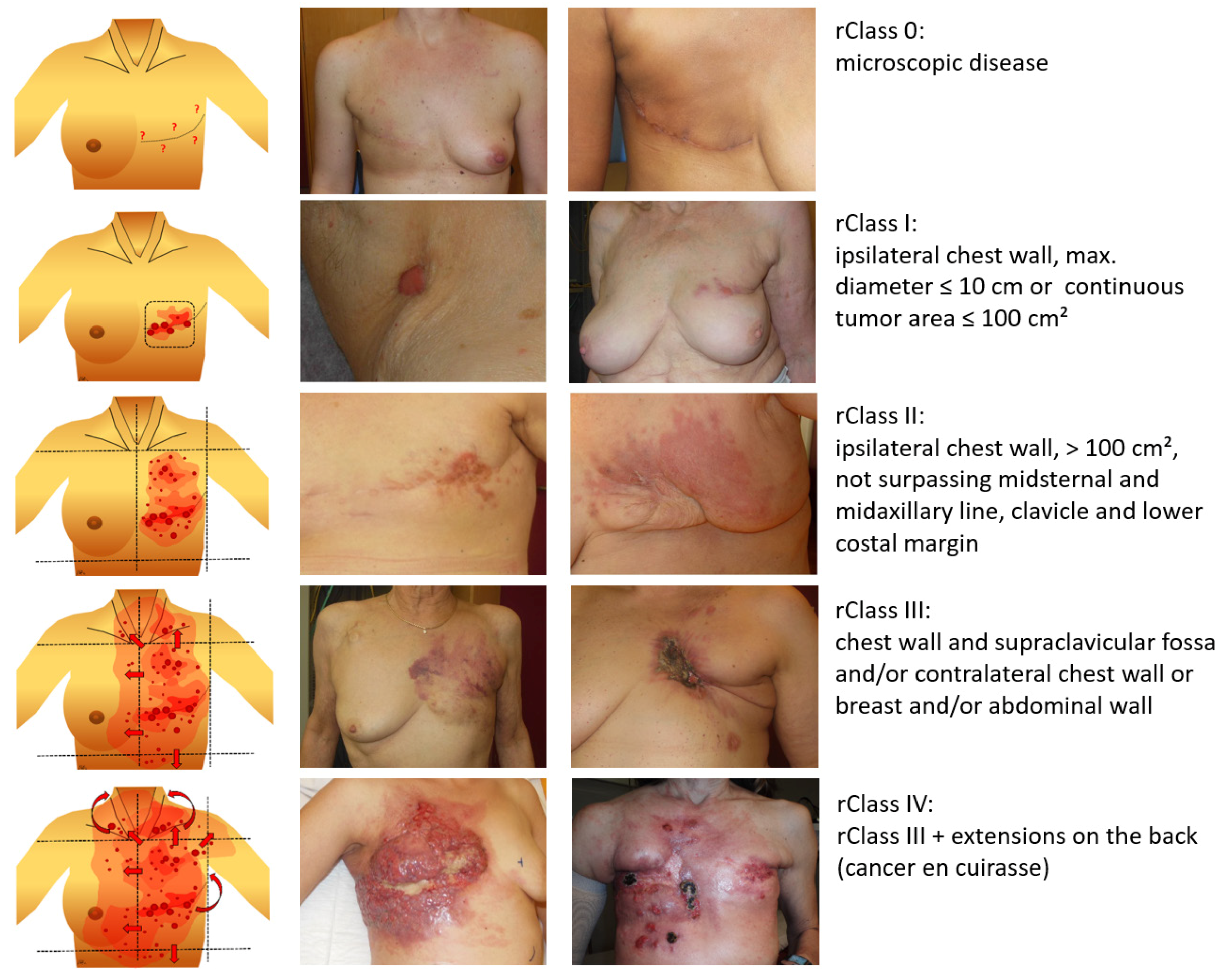 Cancers 12 00606 g001