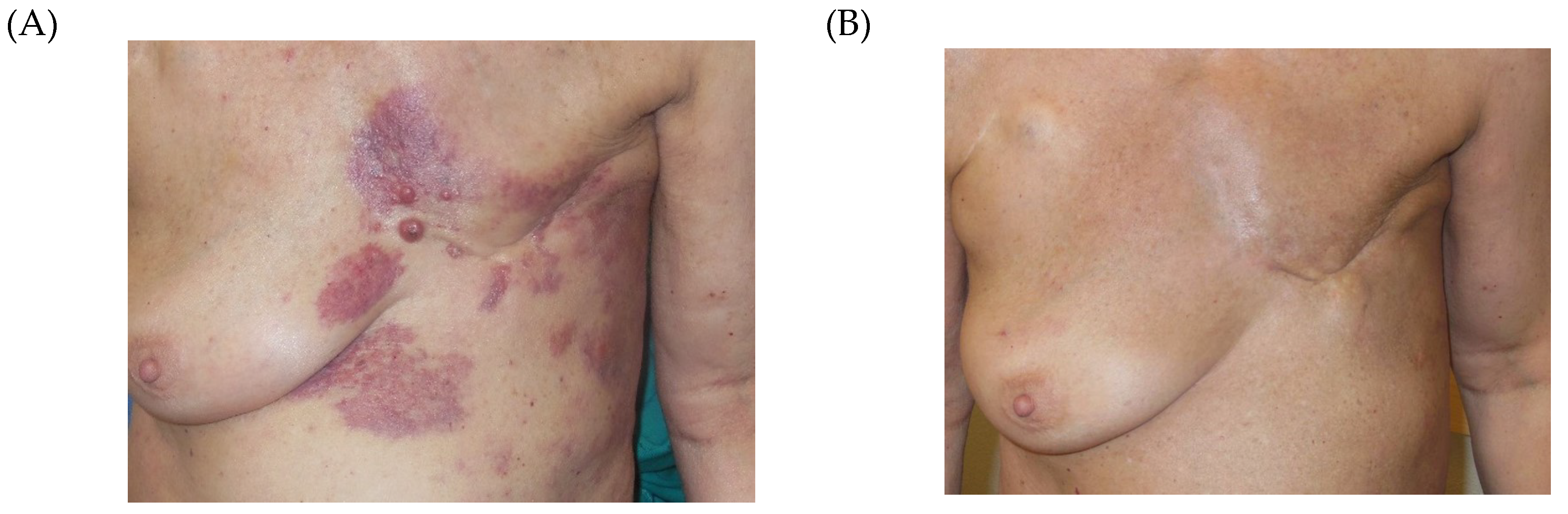 Cancers 12 00606 g003