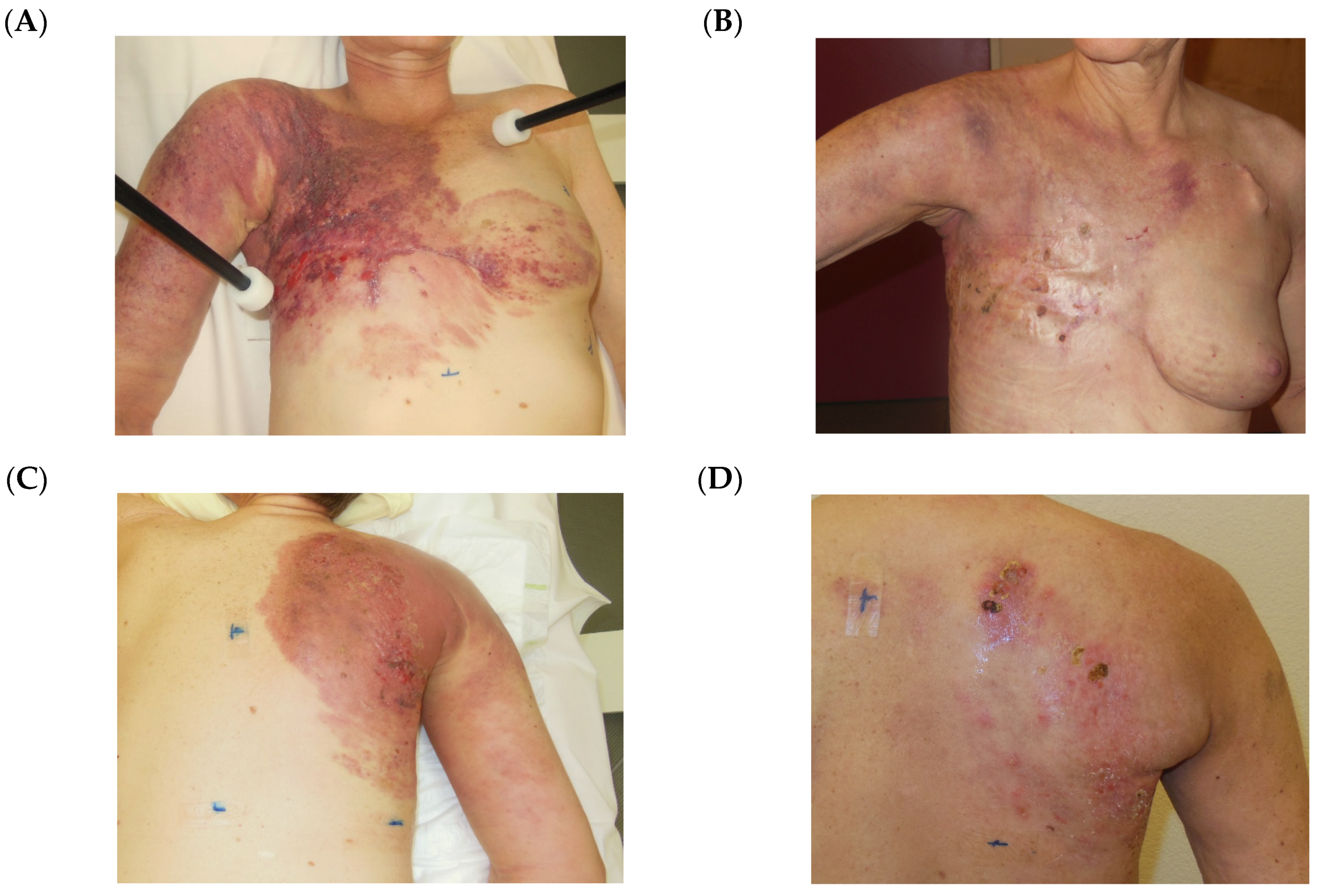 Cancers 12 00606 g004