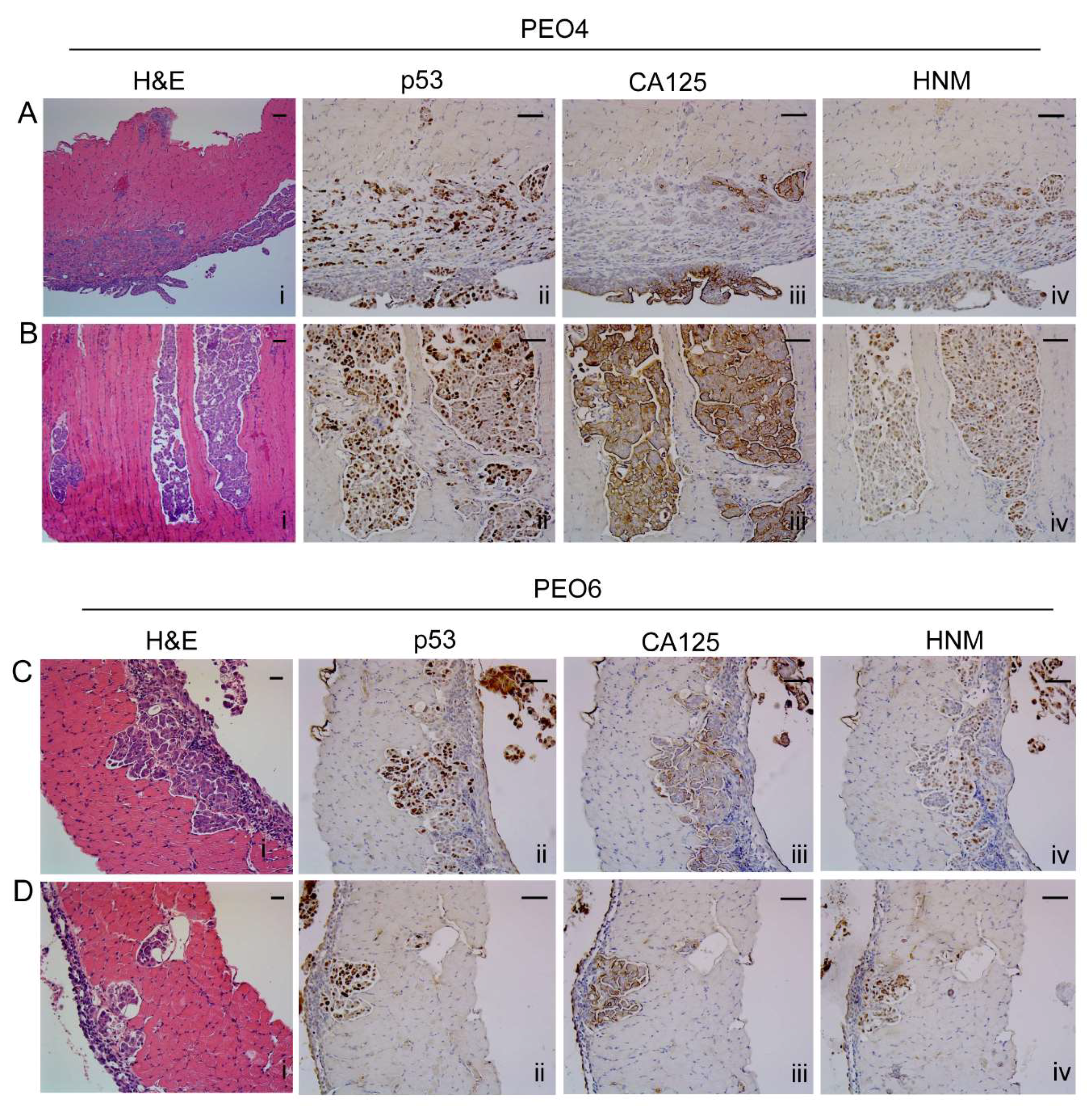 Cancers 12 00699 g004