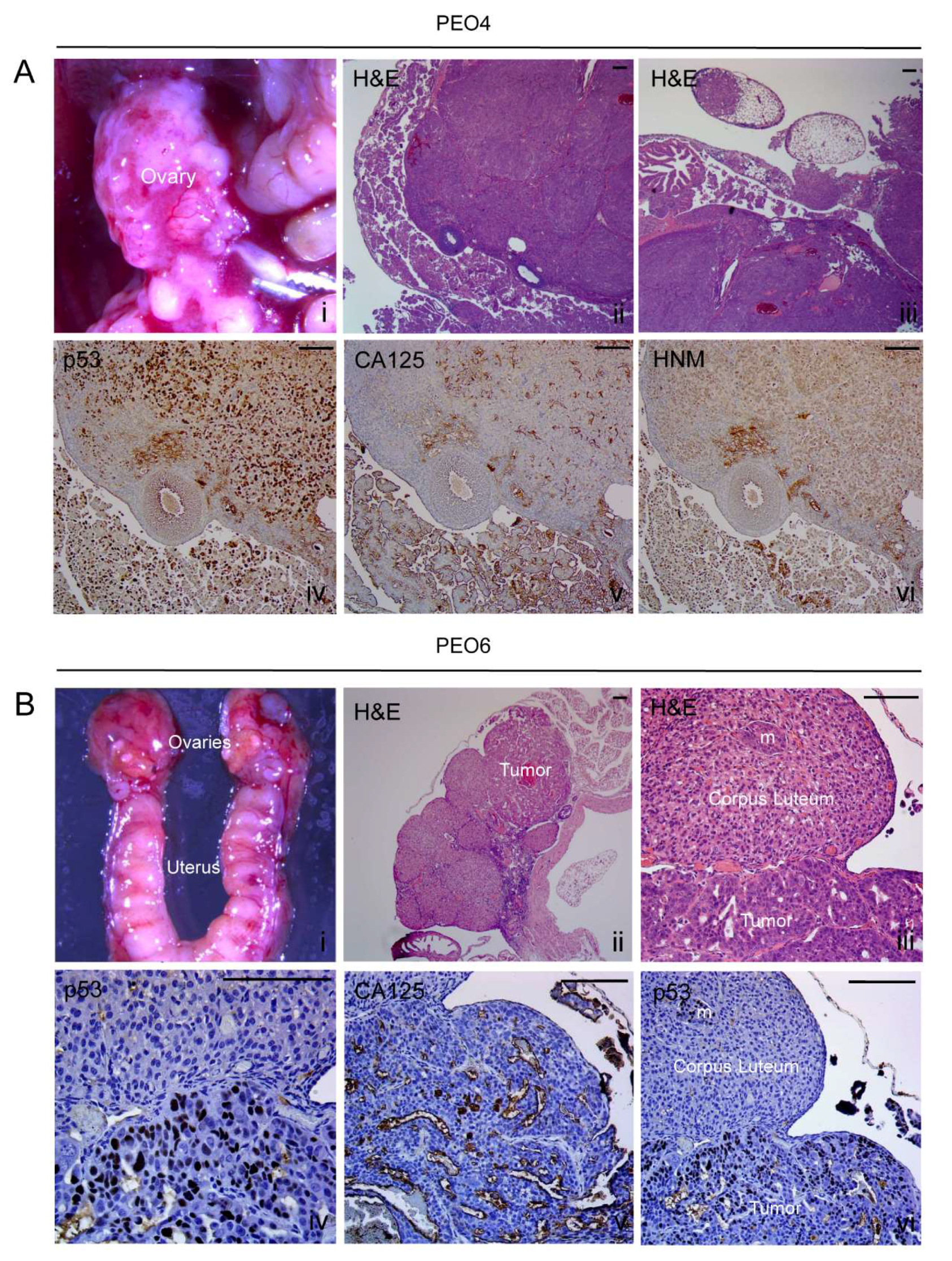 Cancers 12 00699 g006