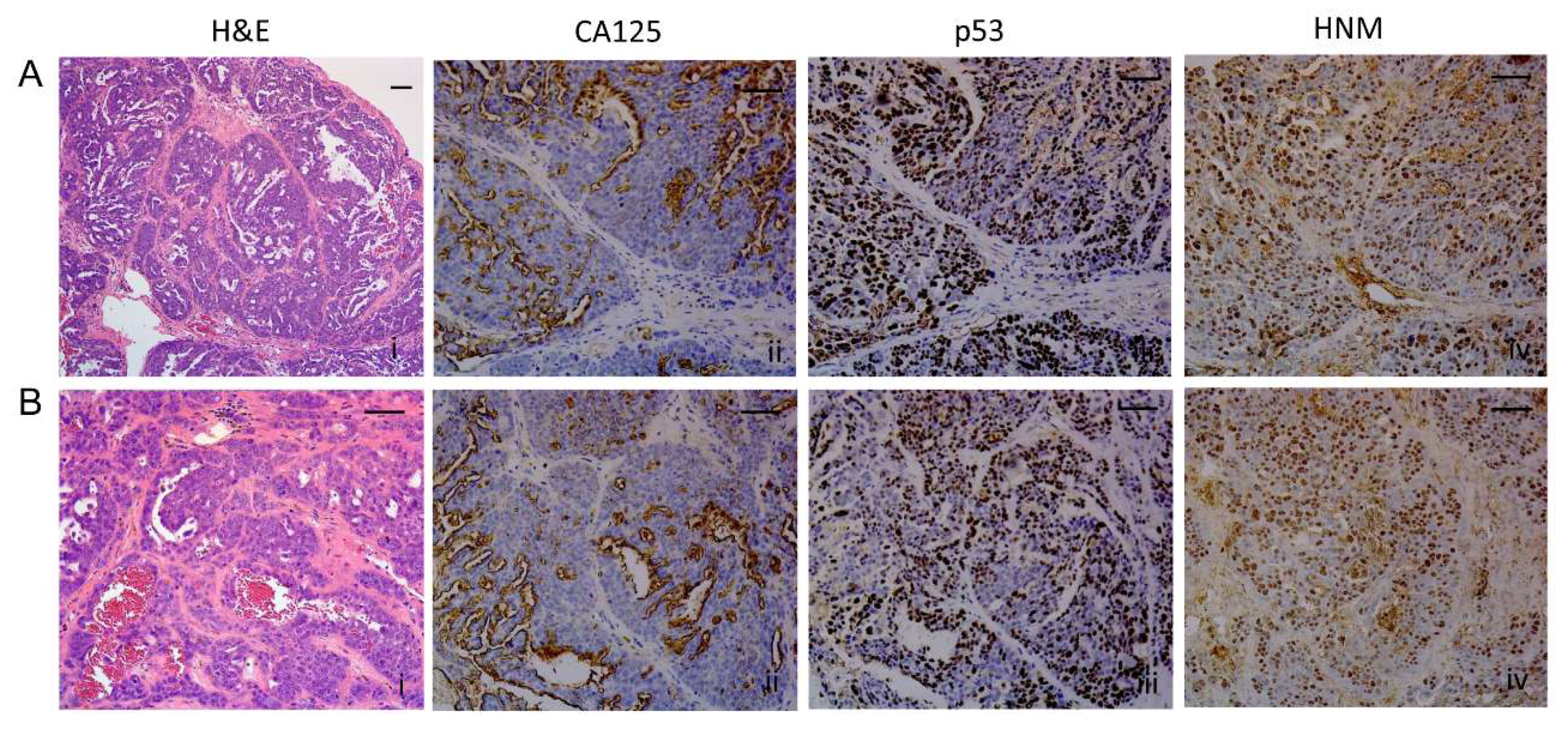 Cancers 12 00699 g010