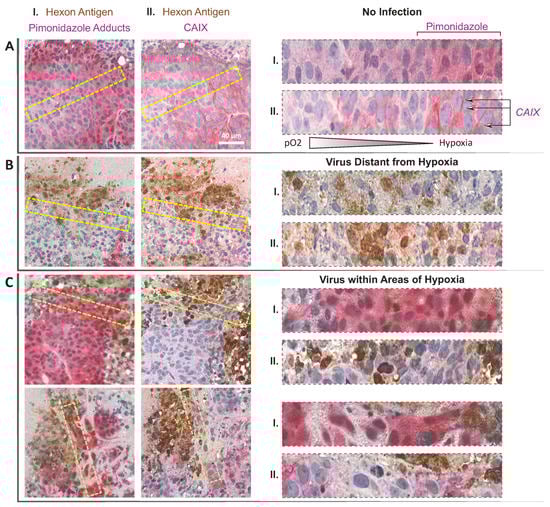 Cancers 12 00851 g0a1