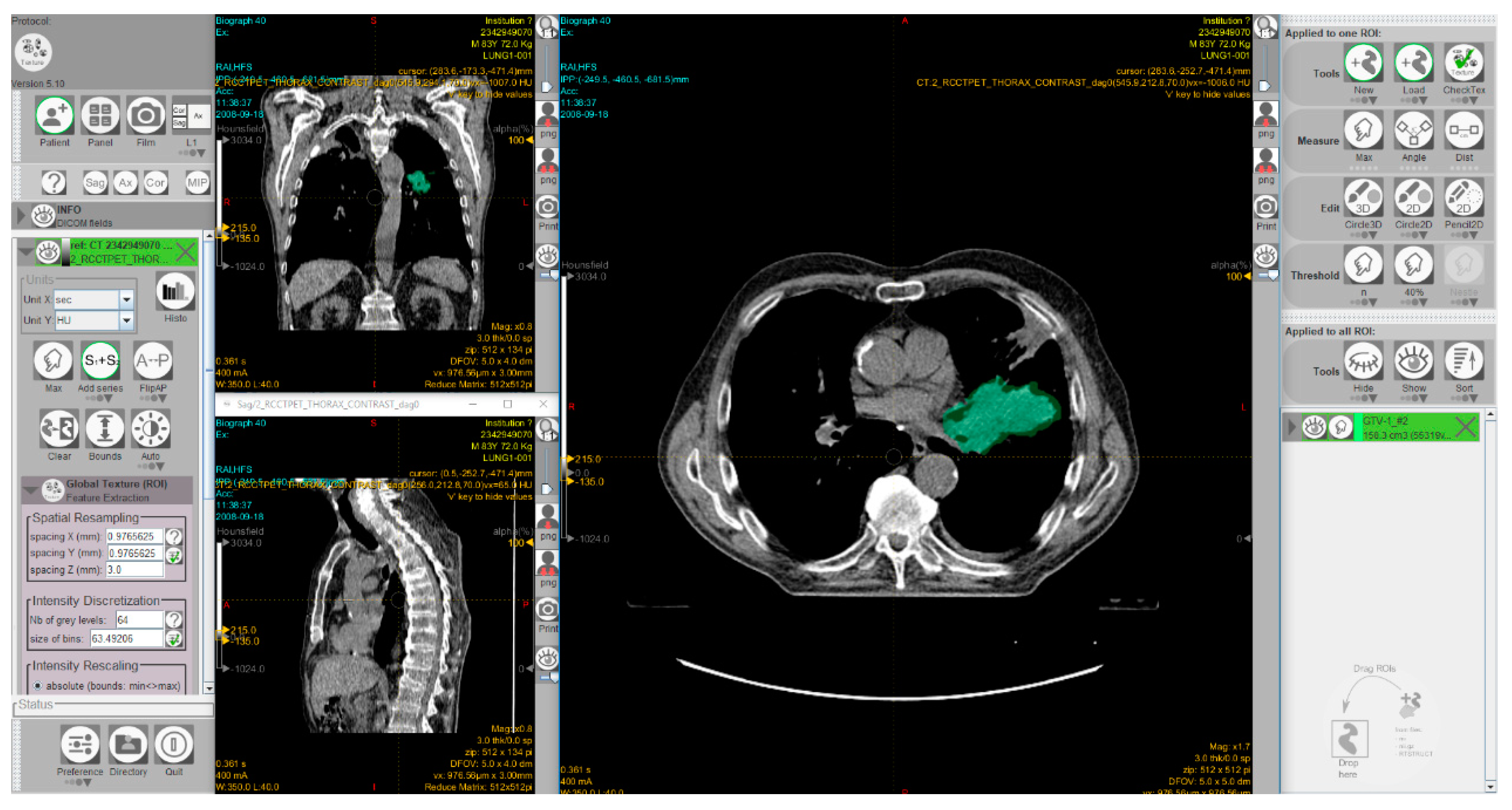 Cancers 12 00889 g005