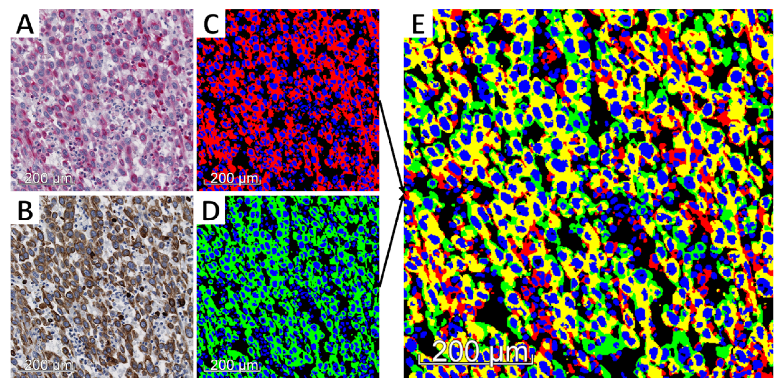 Cancers 12 00906 g003