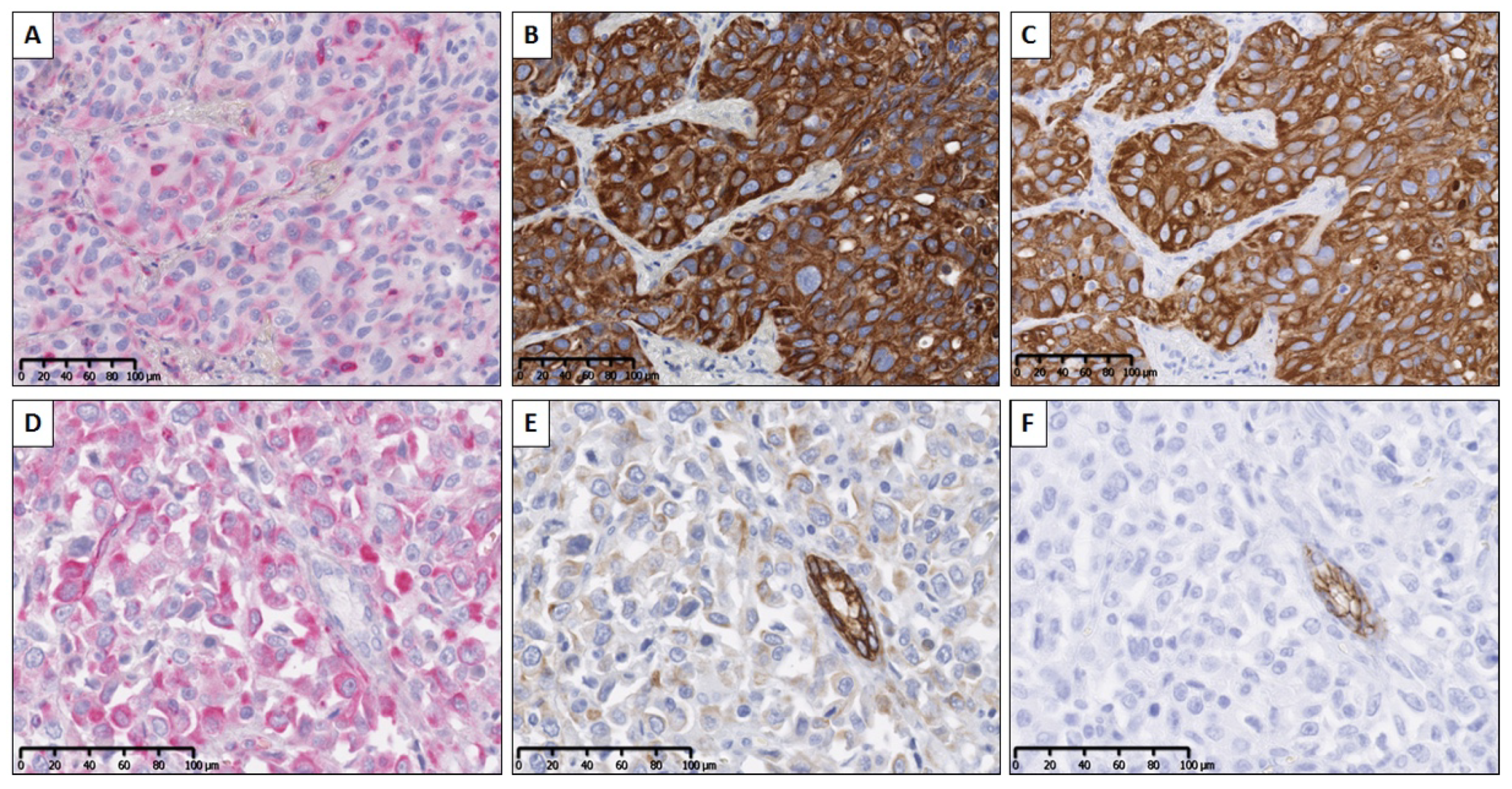 Cancers 12 00906 g004