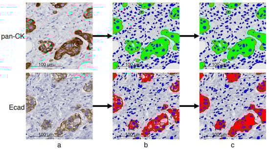 Cancers 12 00906 g0a1