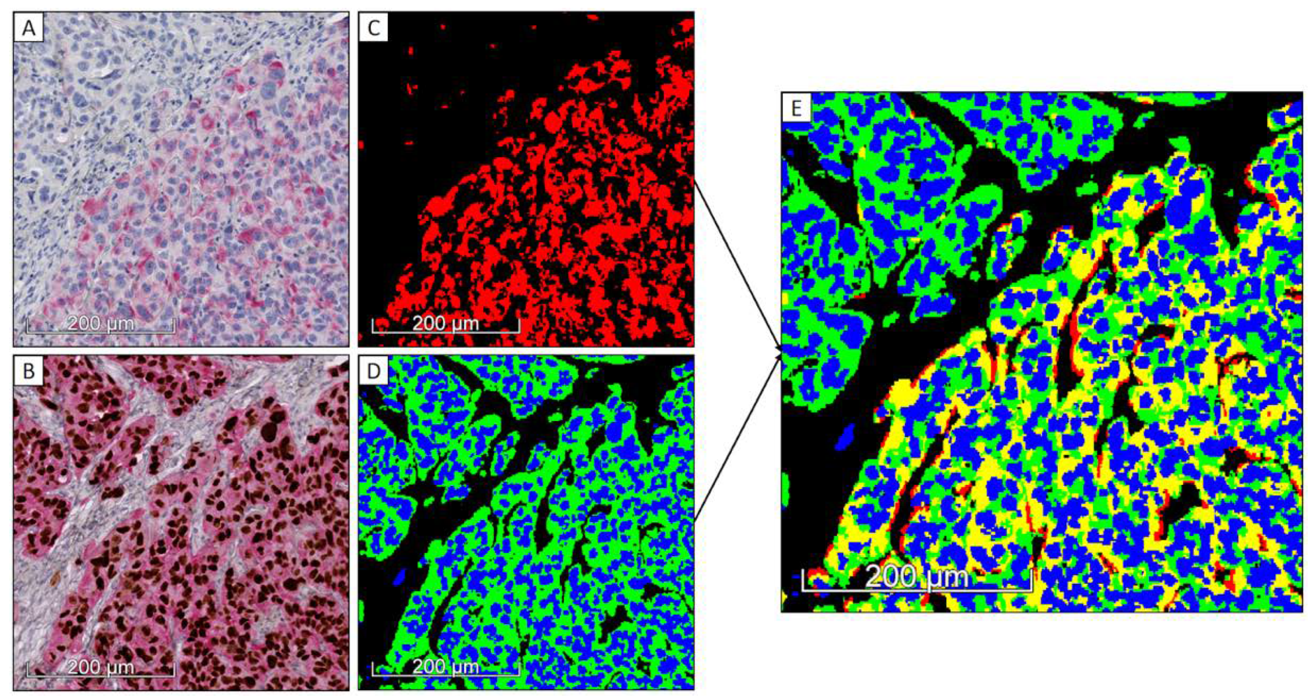 Cancers 12 00906 g0a2