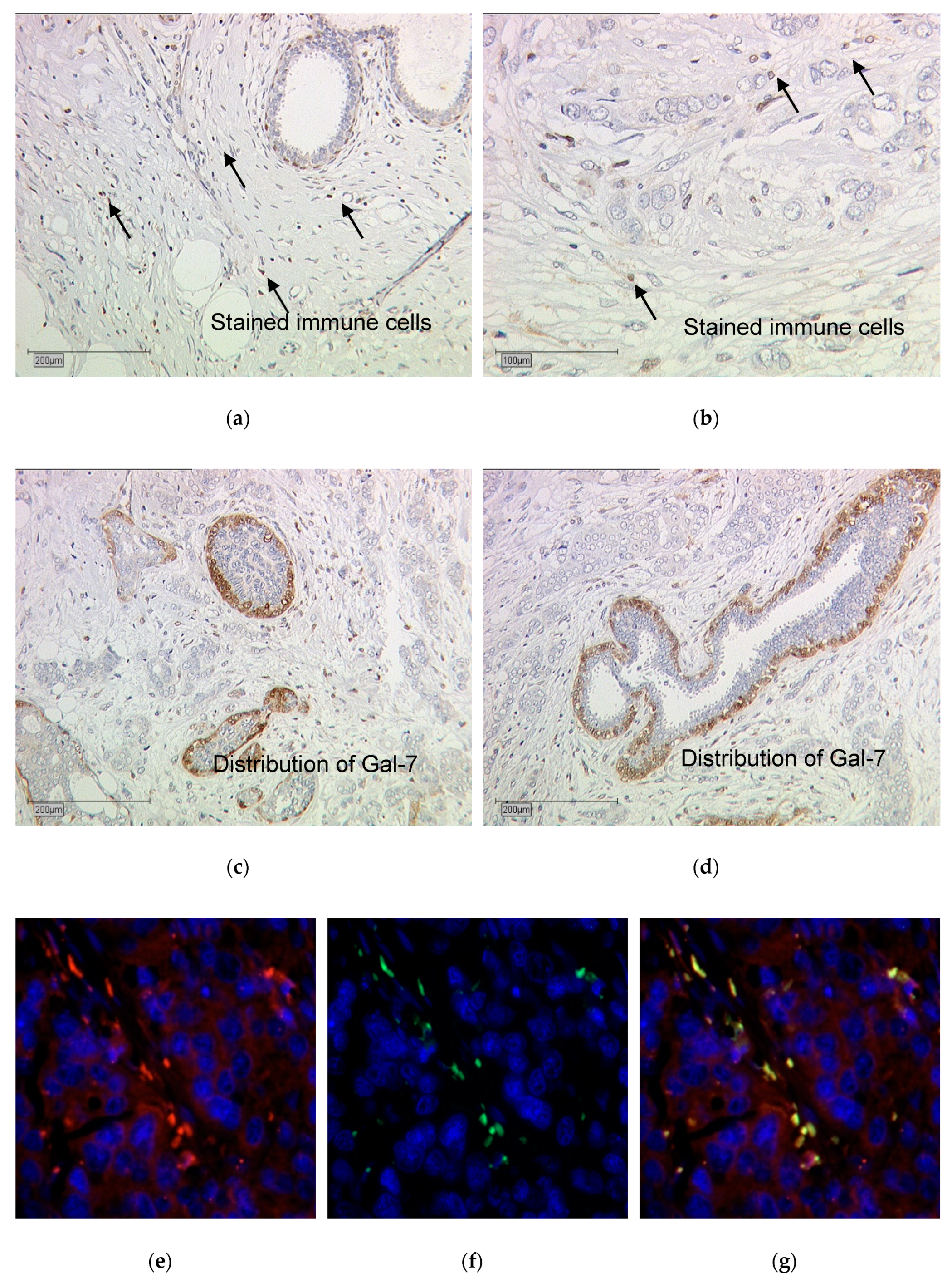 Cancers 12 00953 g008