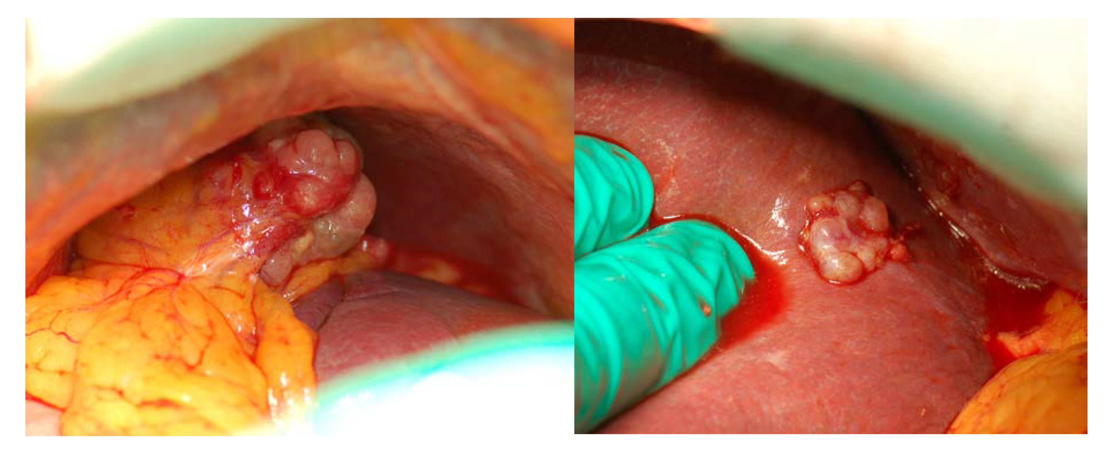 Cancers 12 00969 g003