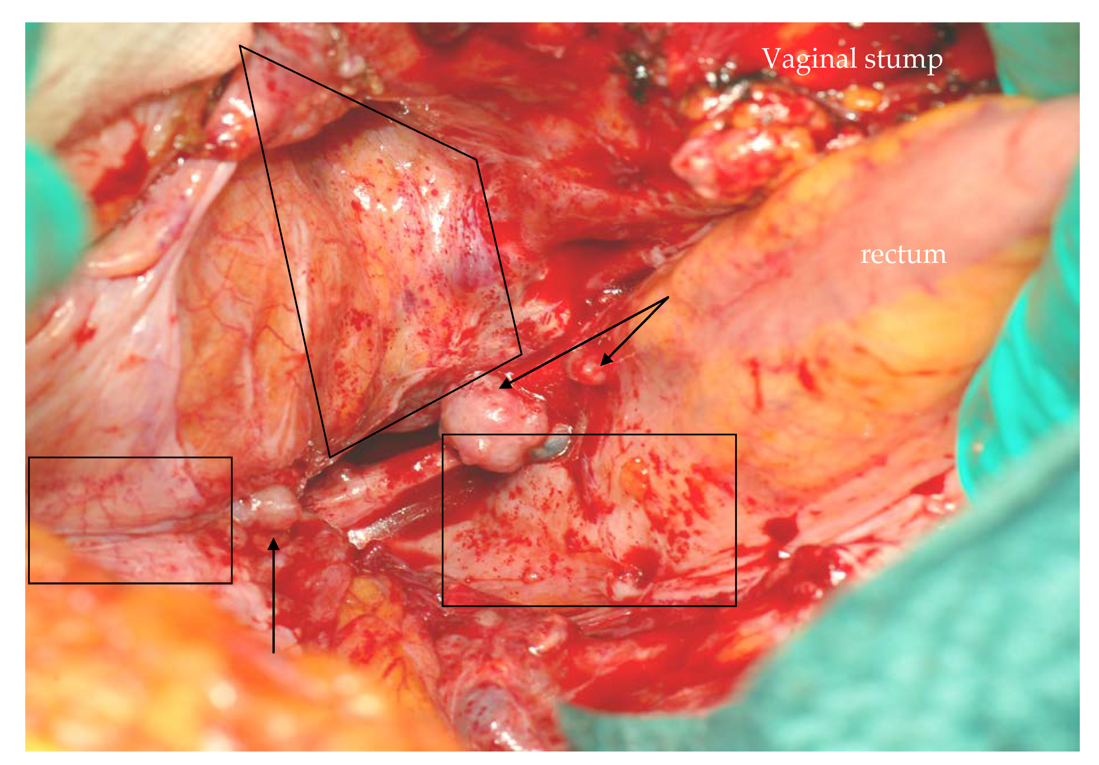 Cancers 12 00969 g004