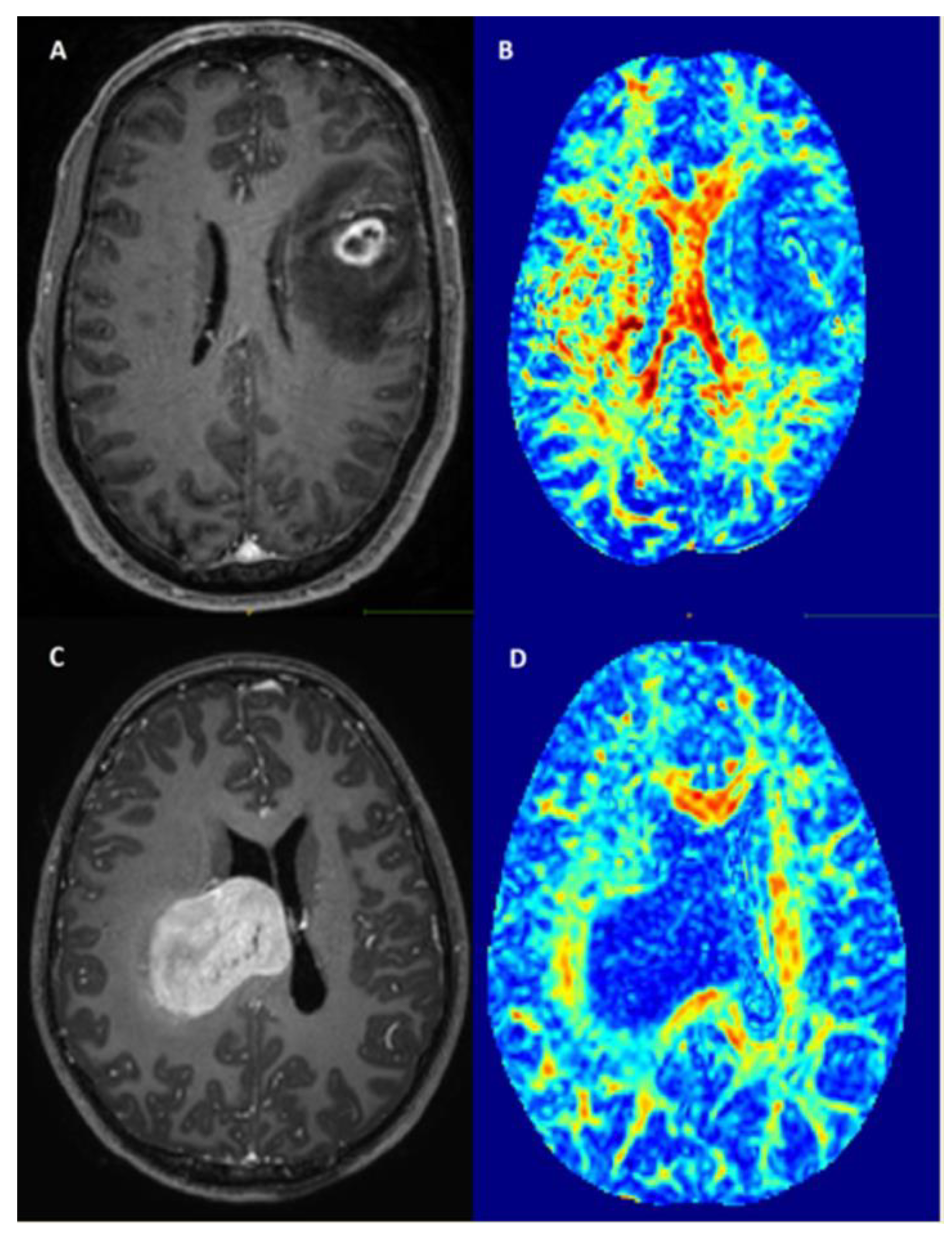 Cancers 12 00994 g002